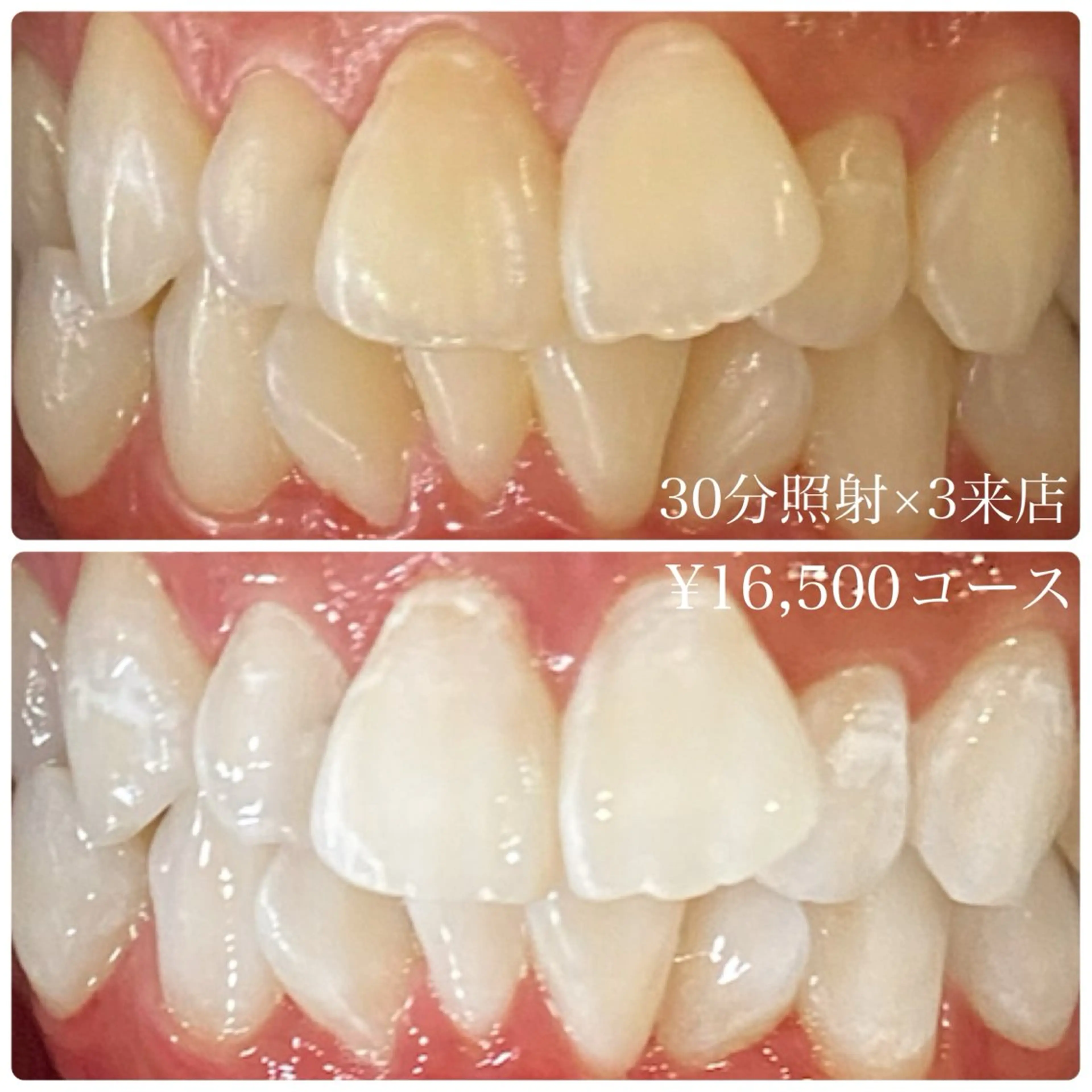 メンズ その他 ホワイトニングルーム　川崎店所属・ホワイトニング ルーム　川崎店のその他イメージ