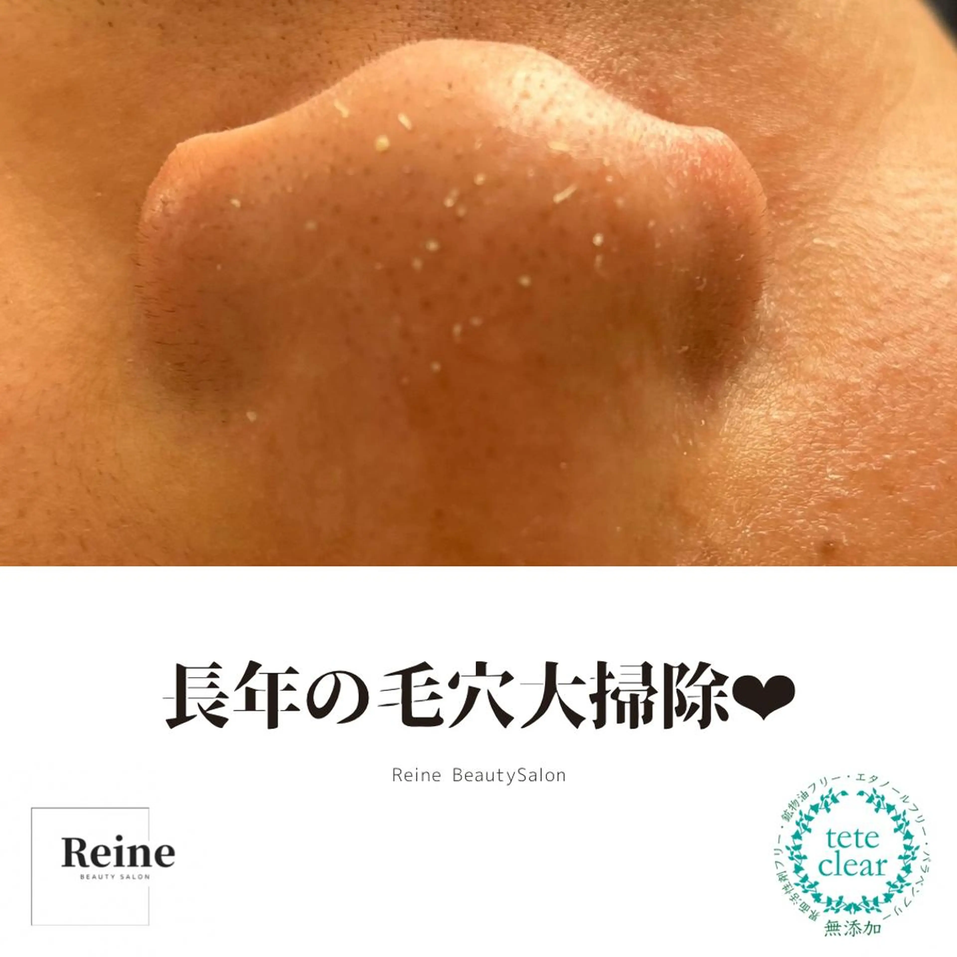 エステ Reine BeautySalon所属・毛穴/シミ肝斑/脱毛 横山梨里のエステ・リラクイメージ