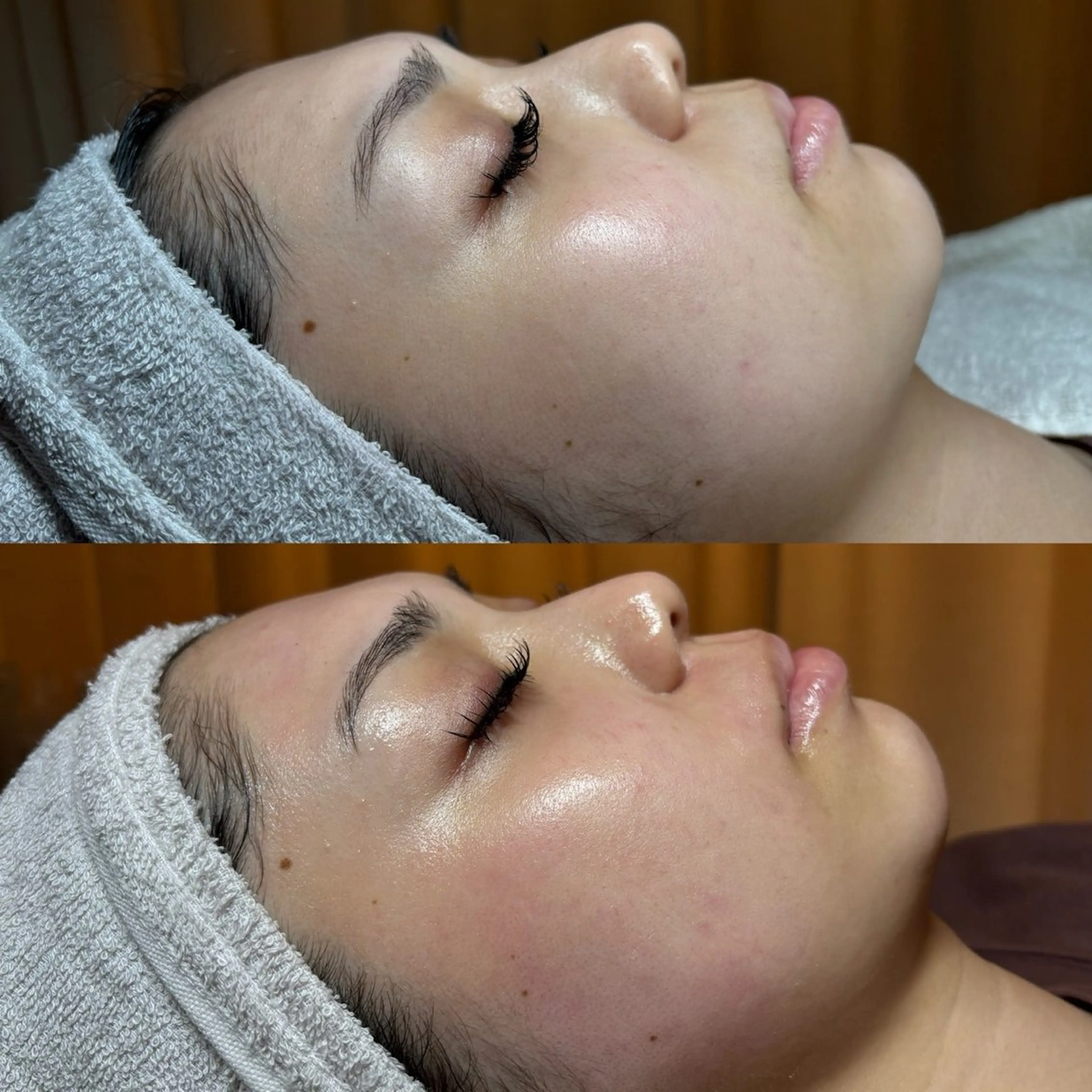 脱毛 小顔/リンパ/マッサージL.sana所属・小顔/フェイシャル L.sanaのエステ・リラクイメージ