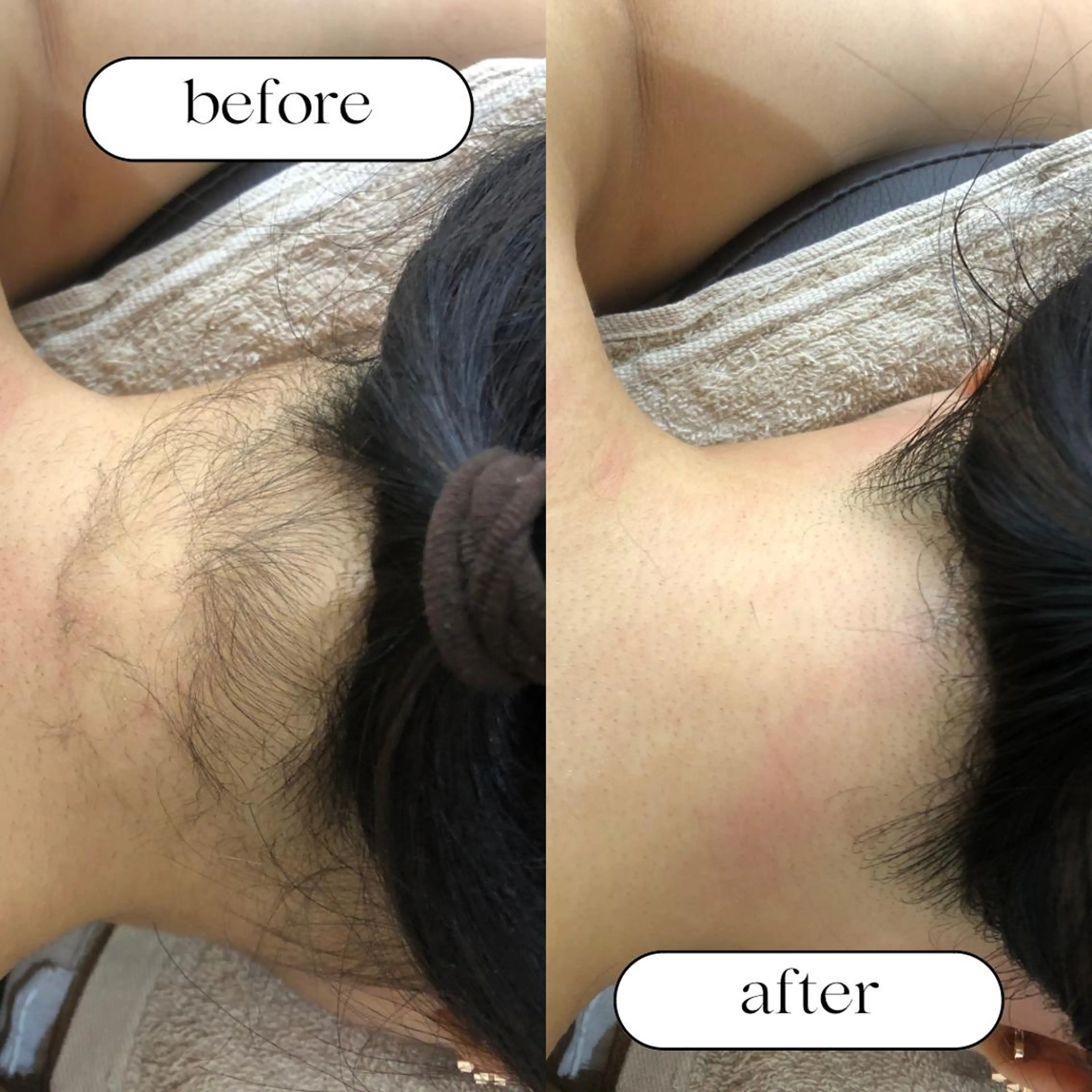 20代から始める脱毛 salonLEPIAのエステ・リラクイメージ