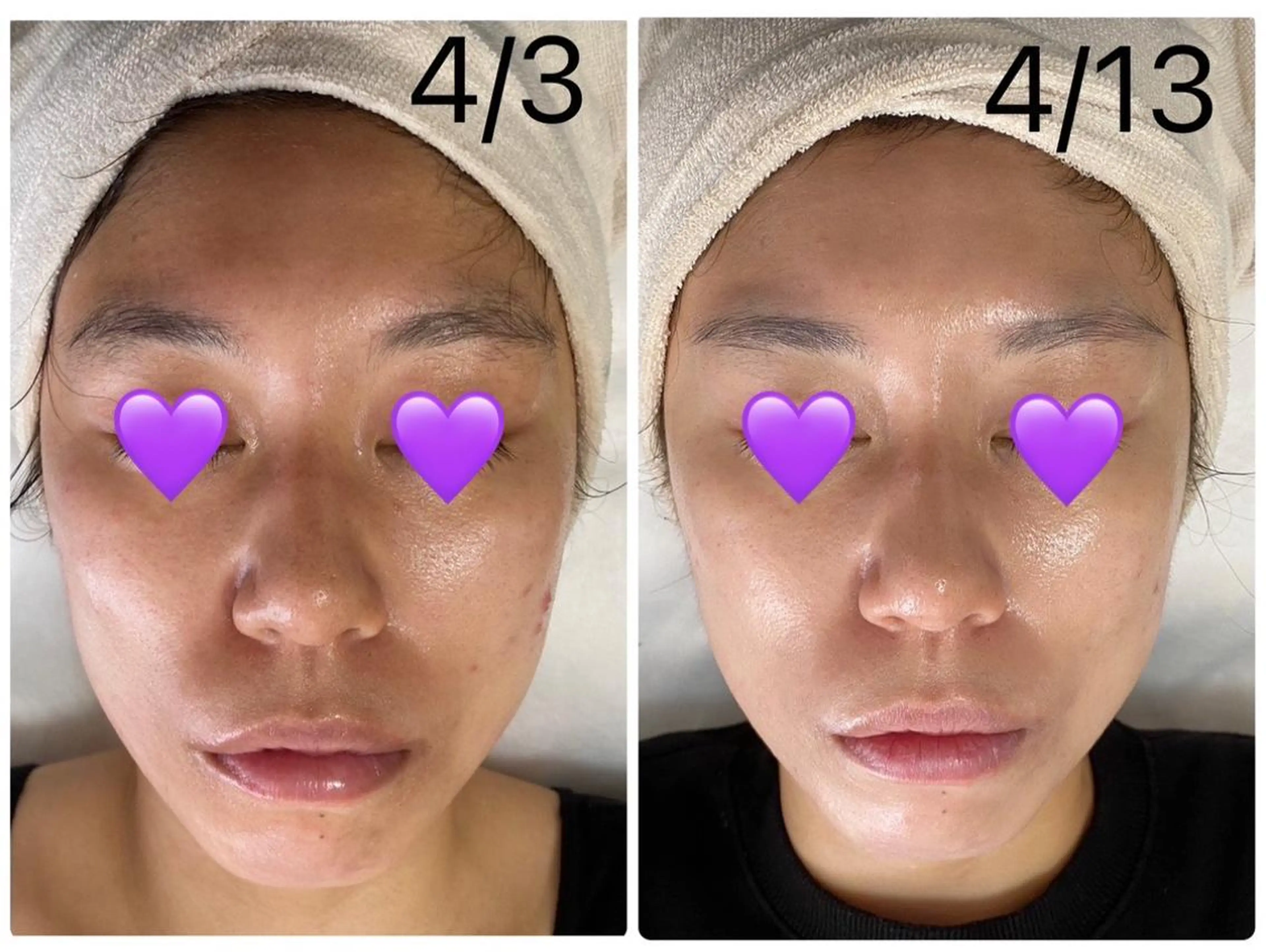 De I'm トータルビューティーサロン所属・COCO beautyサロンのエステ・リラクイメージ