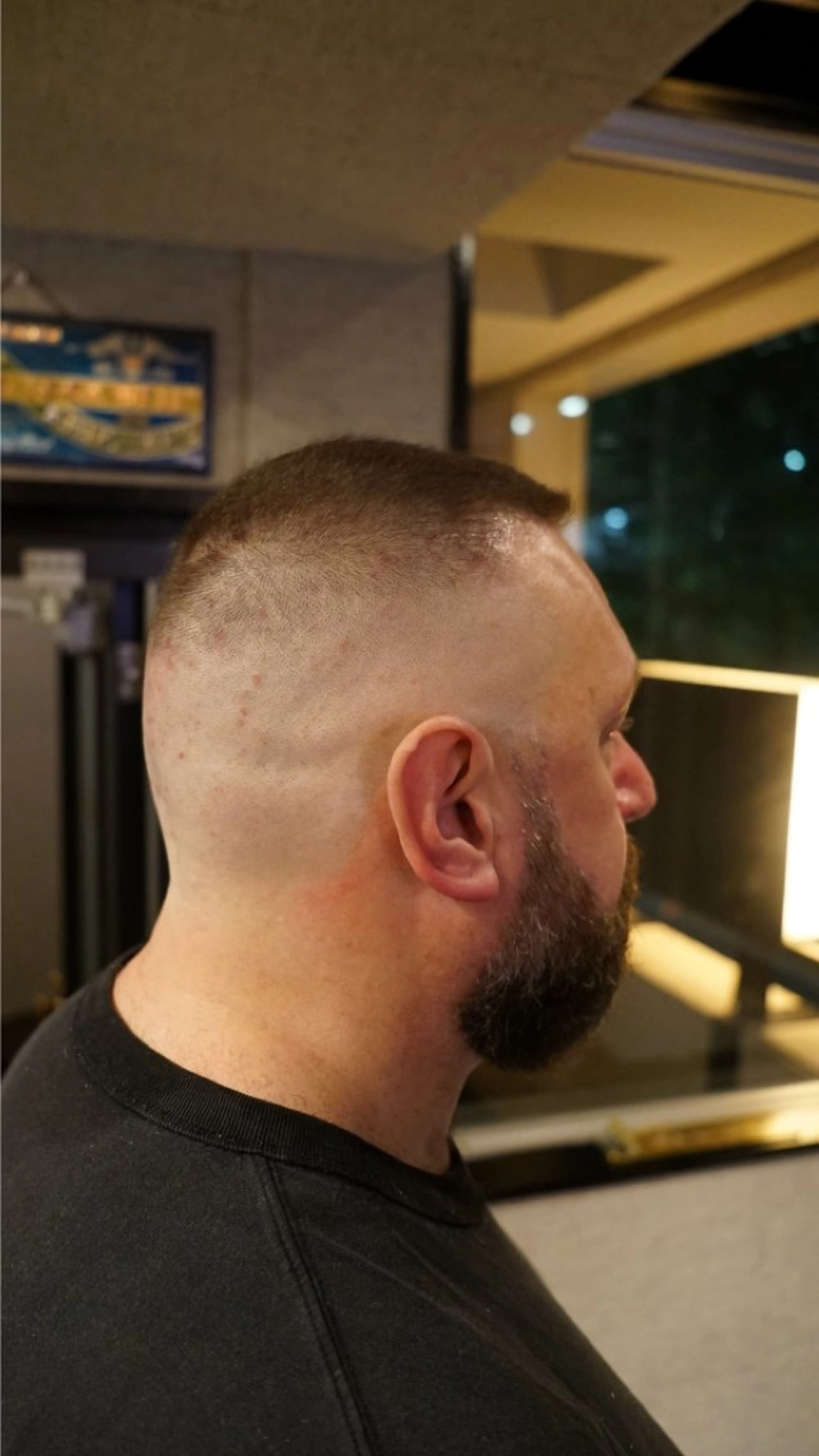 ショート メンズ フェードカット スキンフェード カット DAU BARBER SHOP所属・メンズショート/ 木下拓海のヘアスタイル