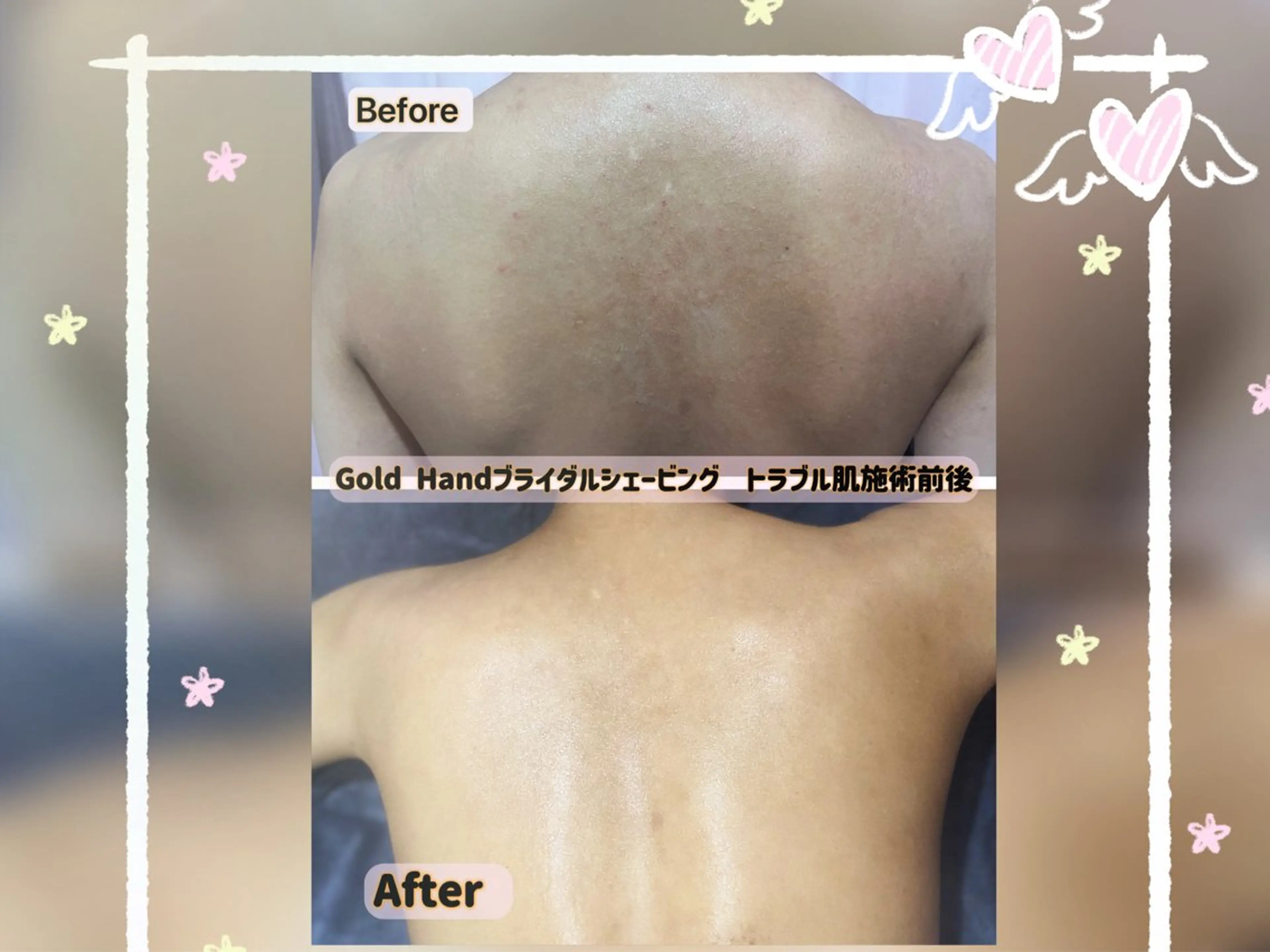 エステ リラク 痩身・小顔Gold hand溝の口店のエステ・リラクイメージ