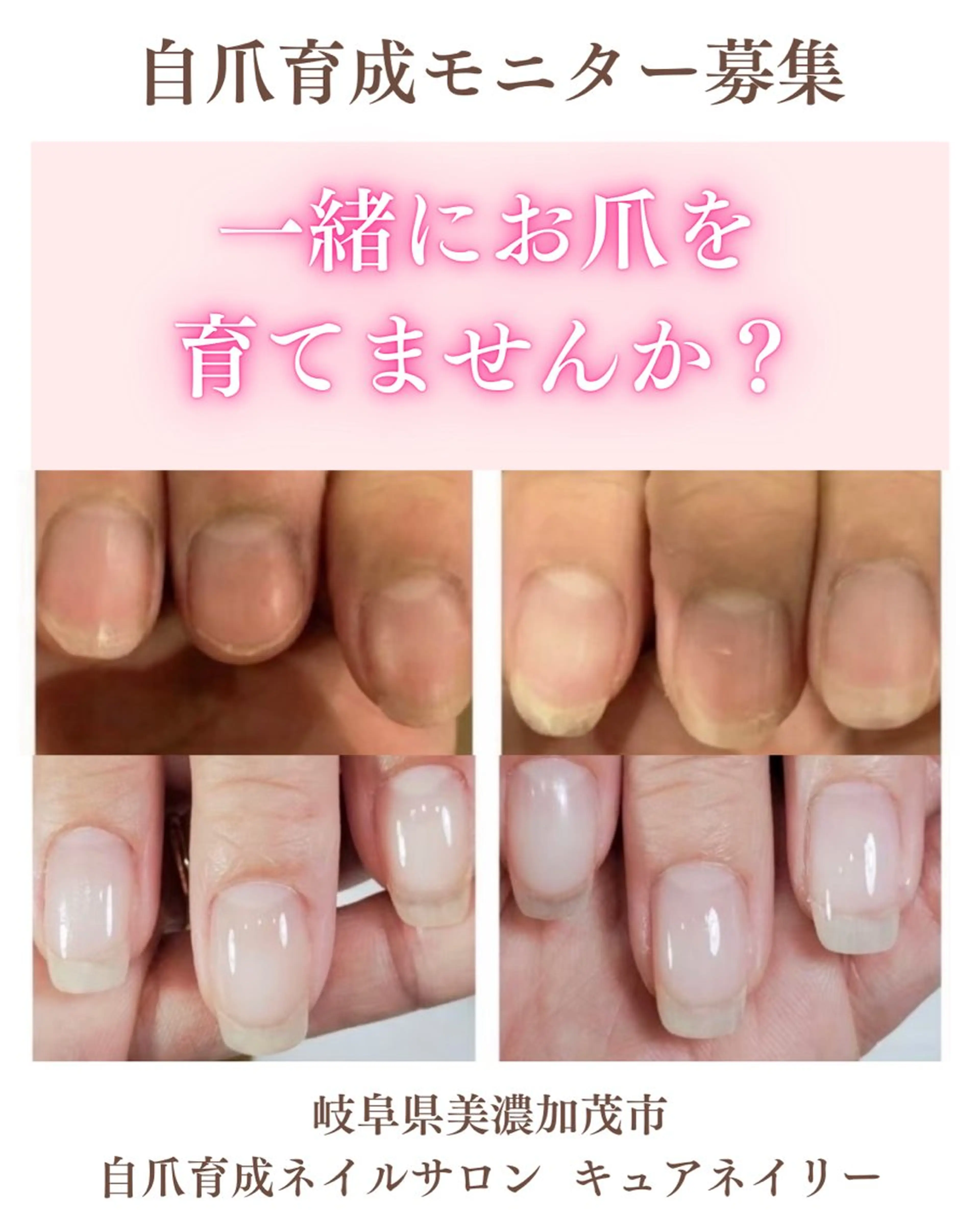 ネイル 木村 優華のネイルデザイン