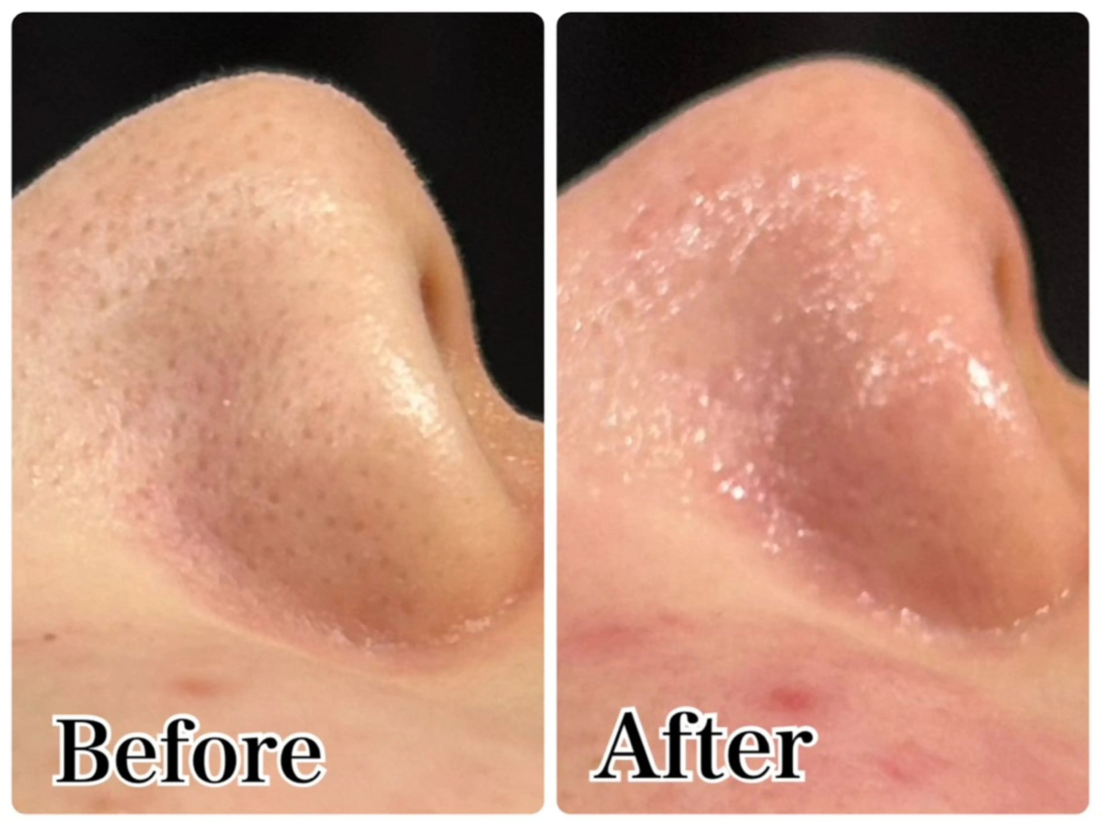 エステ Gemini MIKIのエステ・リラクイメージ