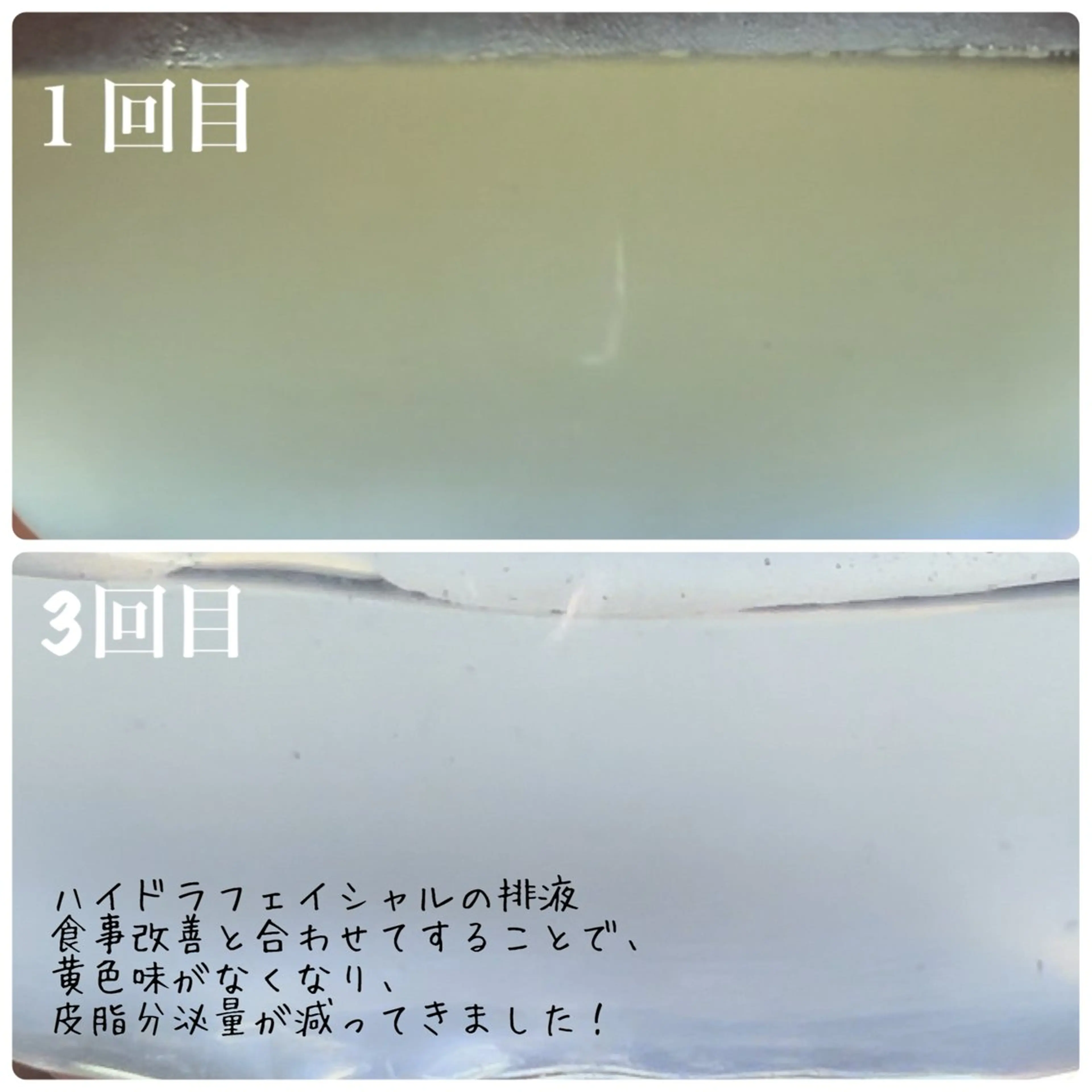 その他 REMENTE 大阪南森町のその他イメージ