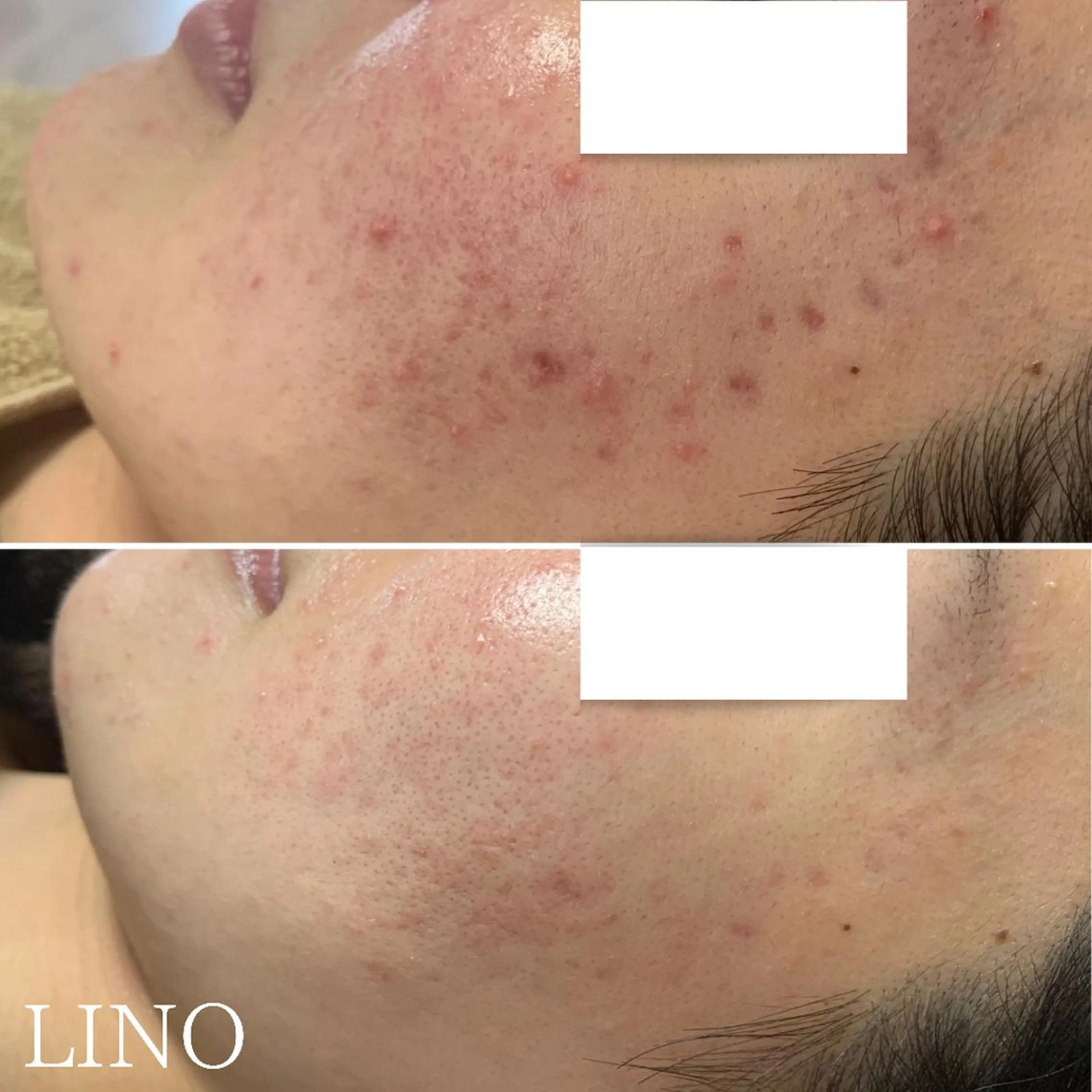 beautysalon  LINO所属・7月限定【平日限定】 全メニュ¥4,400のエステ・リラクイメージ