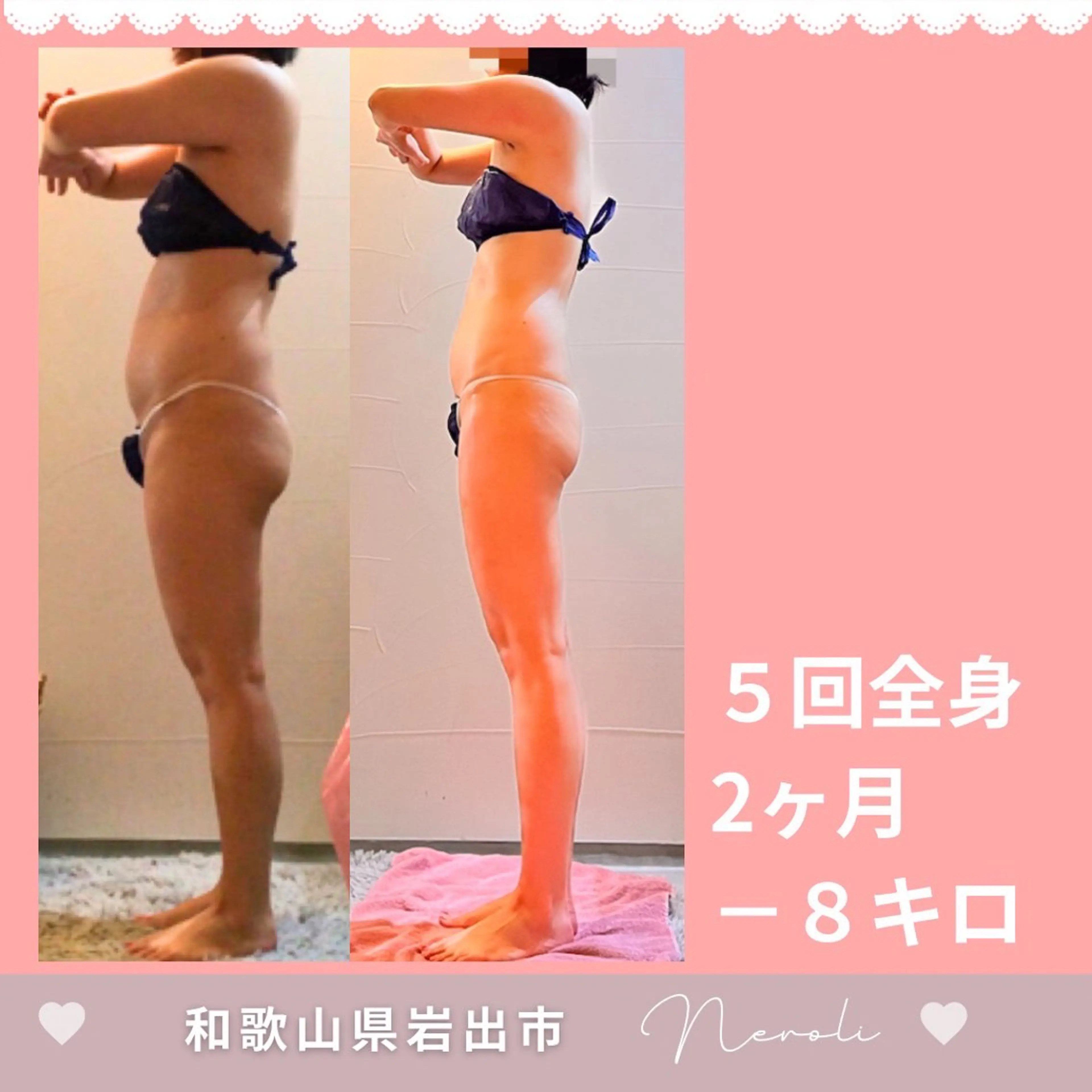 エステ 切らない脂肪吸引🔥 Neroliまりこのエステ・リラクイメージ