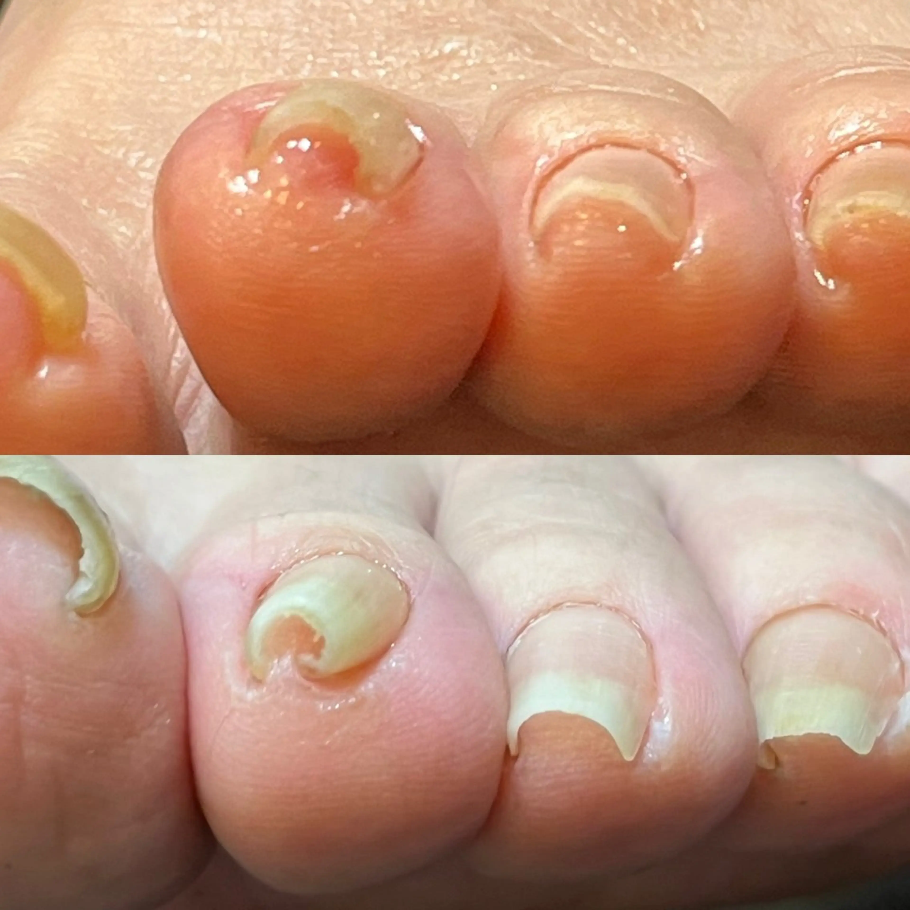 ネイル Atelier Masami 爪や所属・菊池 雅美のネイルデザイン