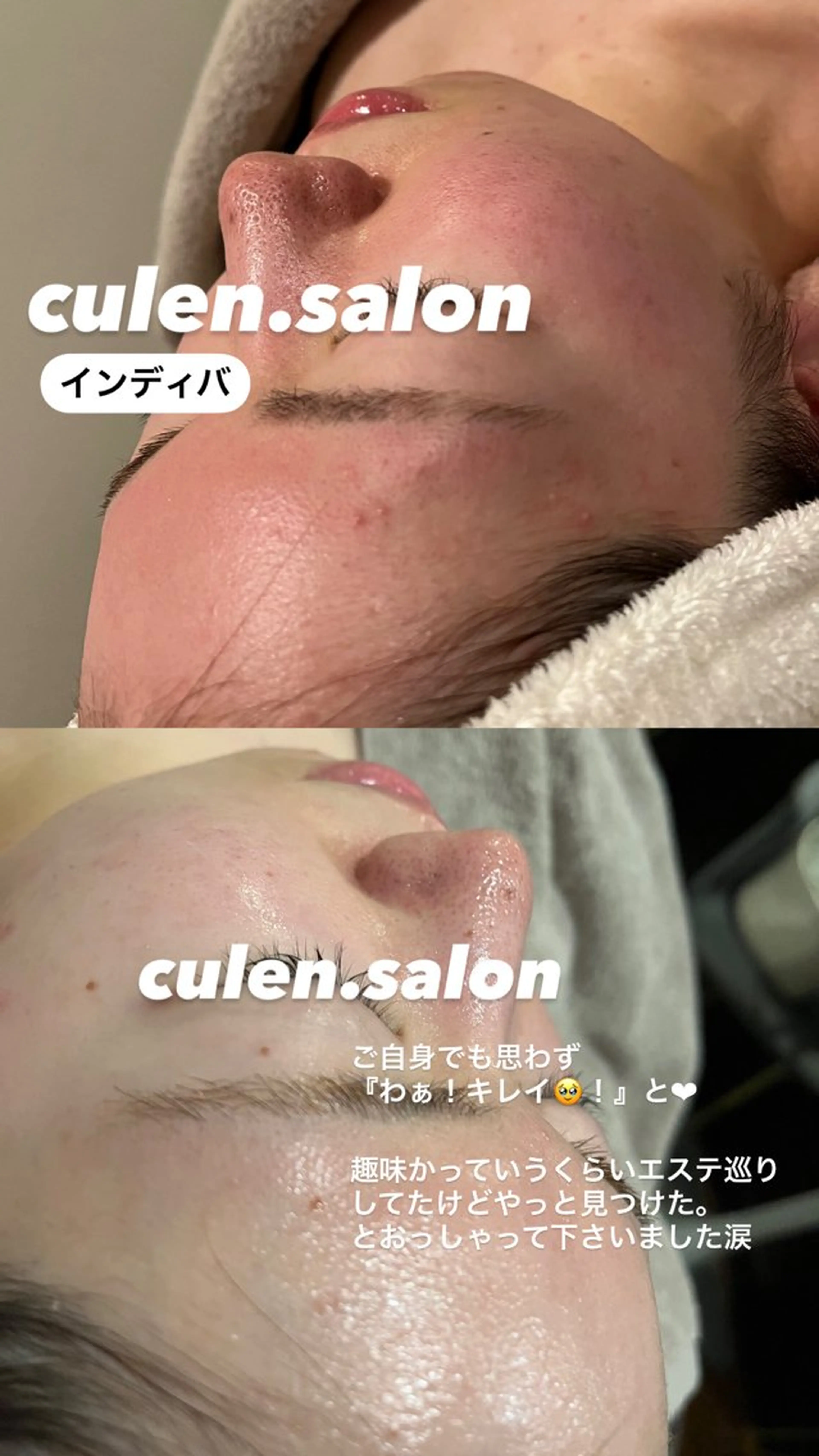 【天神】毛穴・インデ ィバ・ボディケアのエステ・リラクイメージ