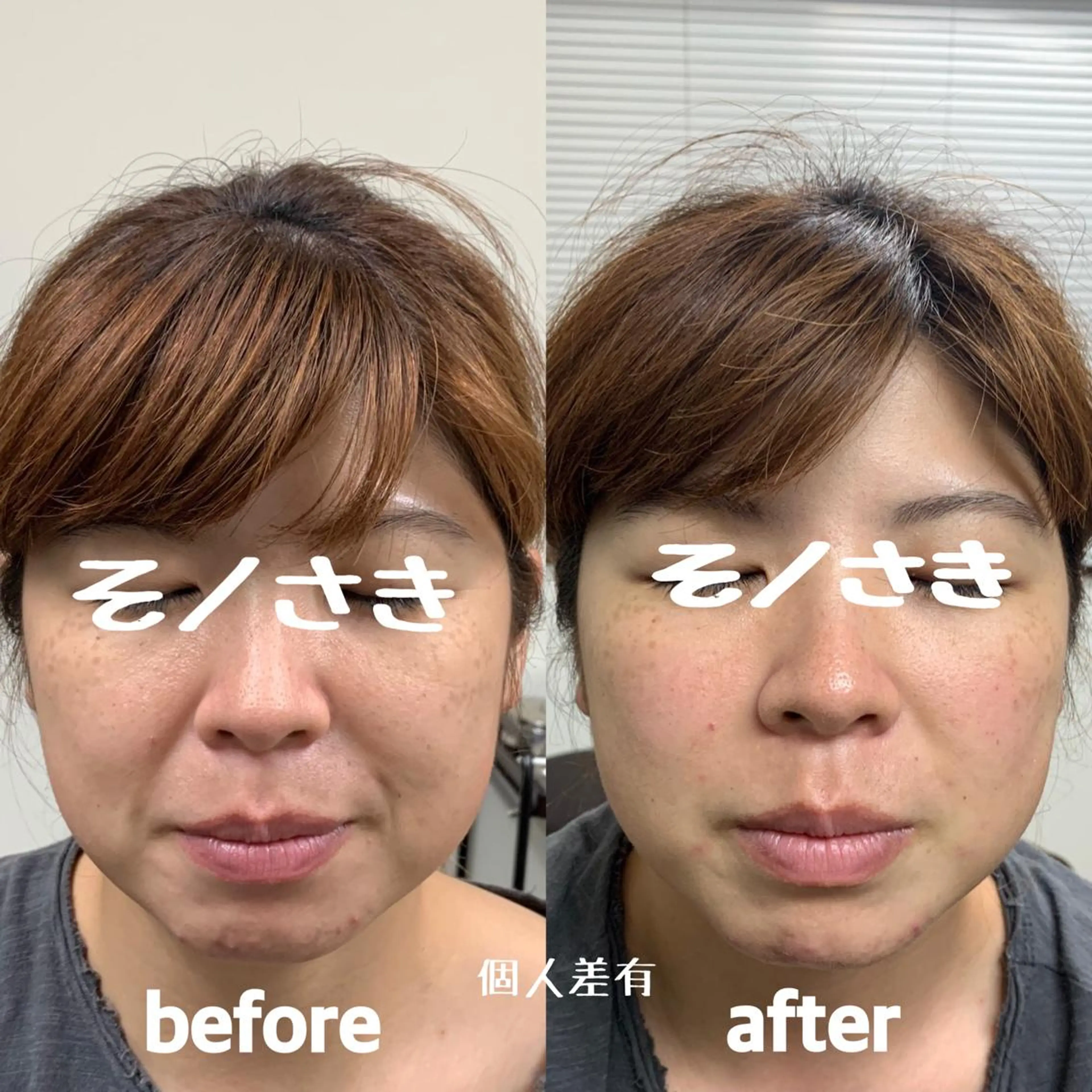 そノさき所属・大阪のシーサー🦁 島袋のエステ・リラクイメージ