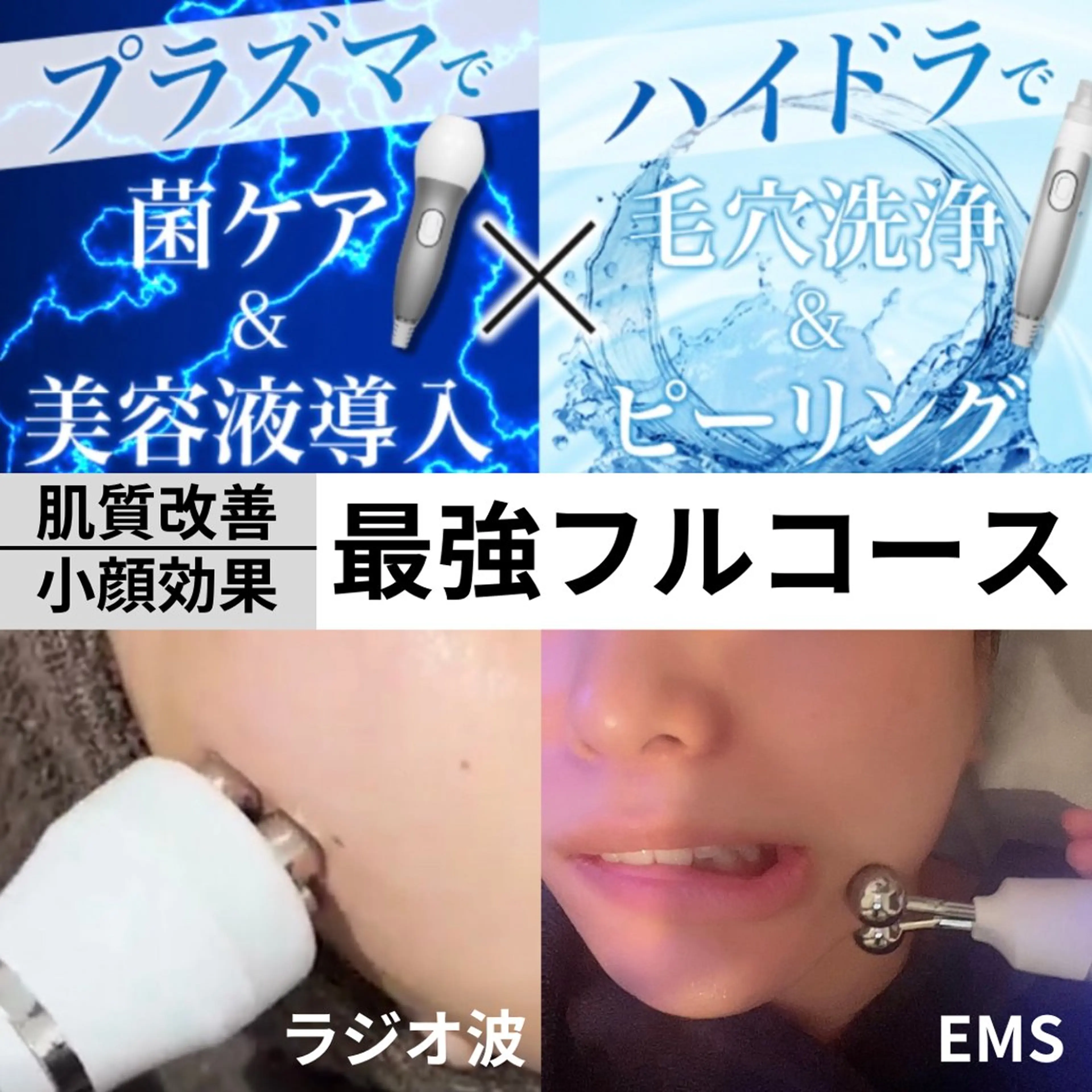 【ハイドラ吸引×プラズマ×RF×EMS】毛穴汚れ、ニキビ肌ケア、浮腫み、表情筋アプローチ！肌質改善も小顔も叶えたい方に✨の写真
