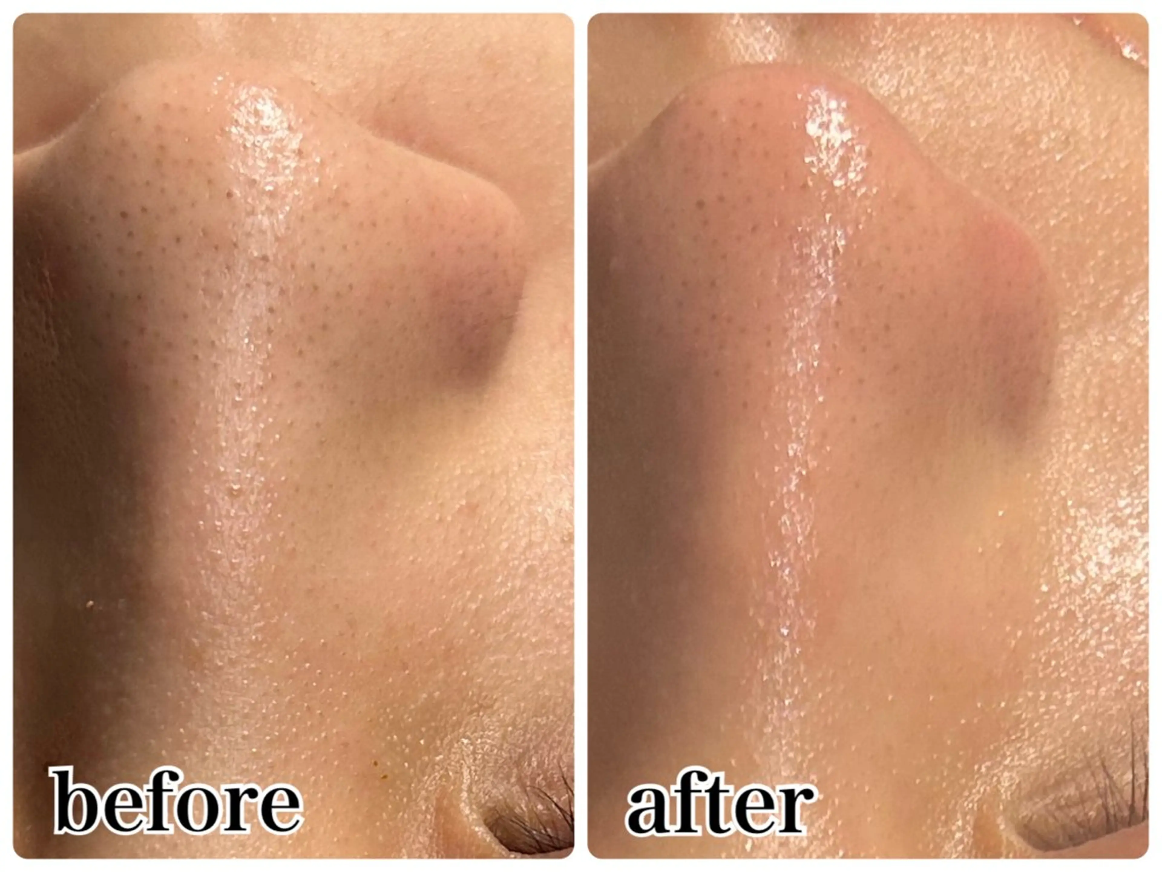 エステ Gemini 　MIKIのエステ・リラクイメージ