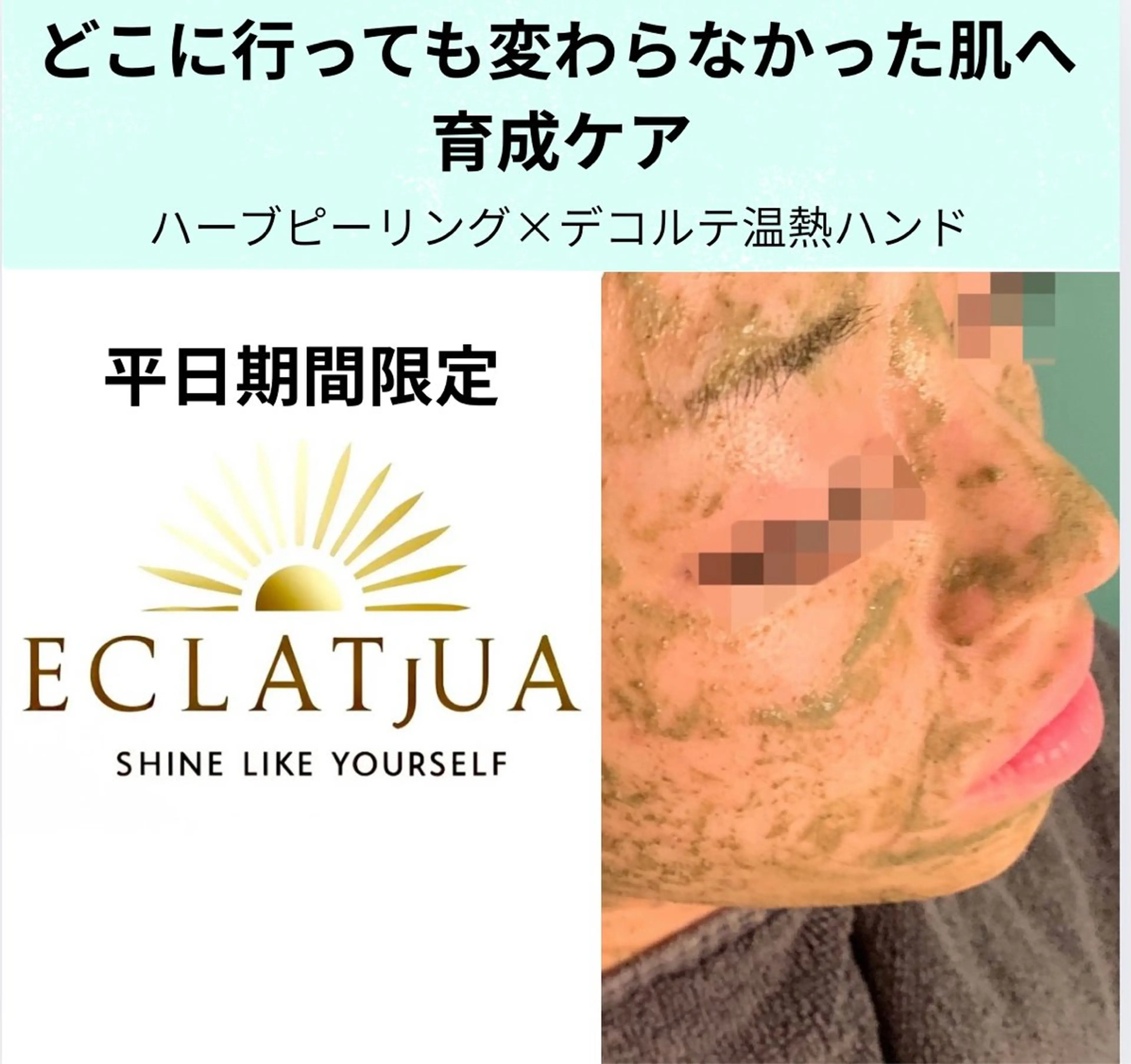 【平日限定🉐ハーブピーリングで透明肌2回🌿】繰り返すあごニキビ＆毛穴解消71.200→‬18.000円の写真