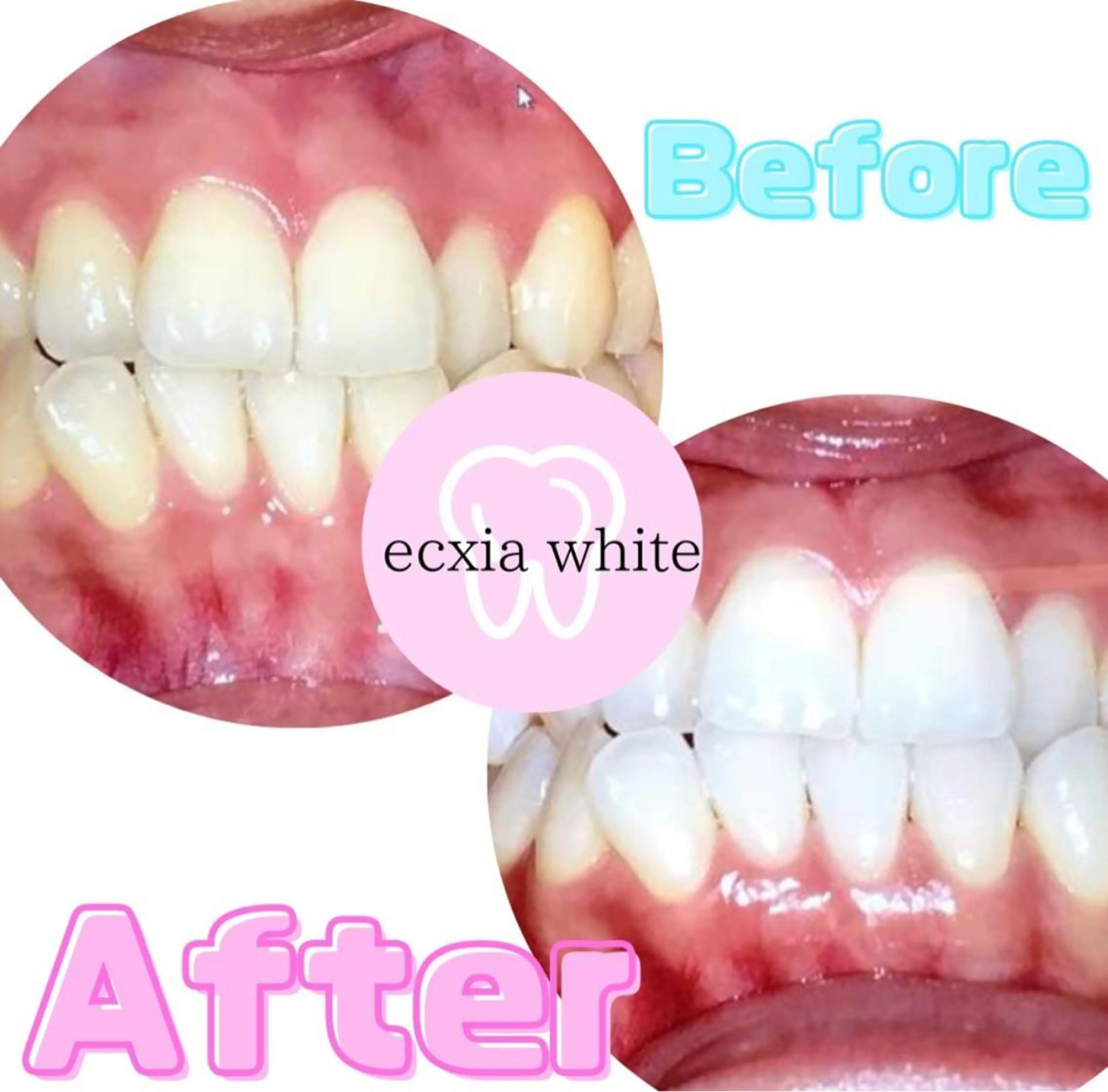 その他 ecxia新宿西口店所属・セルフホワイトニング エクシア新宿西口店のその他イメージ