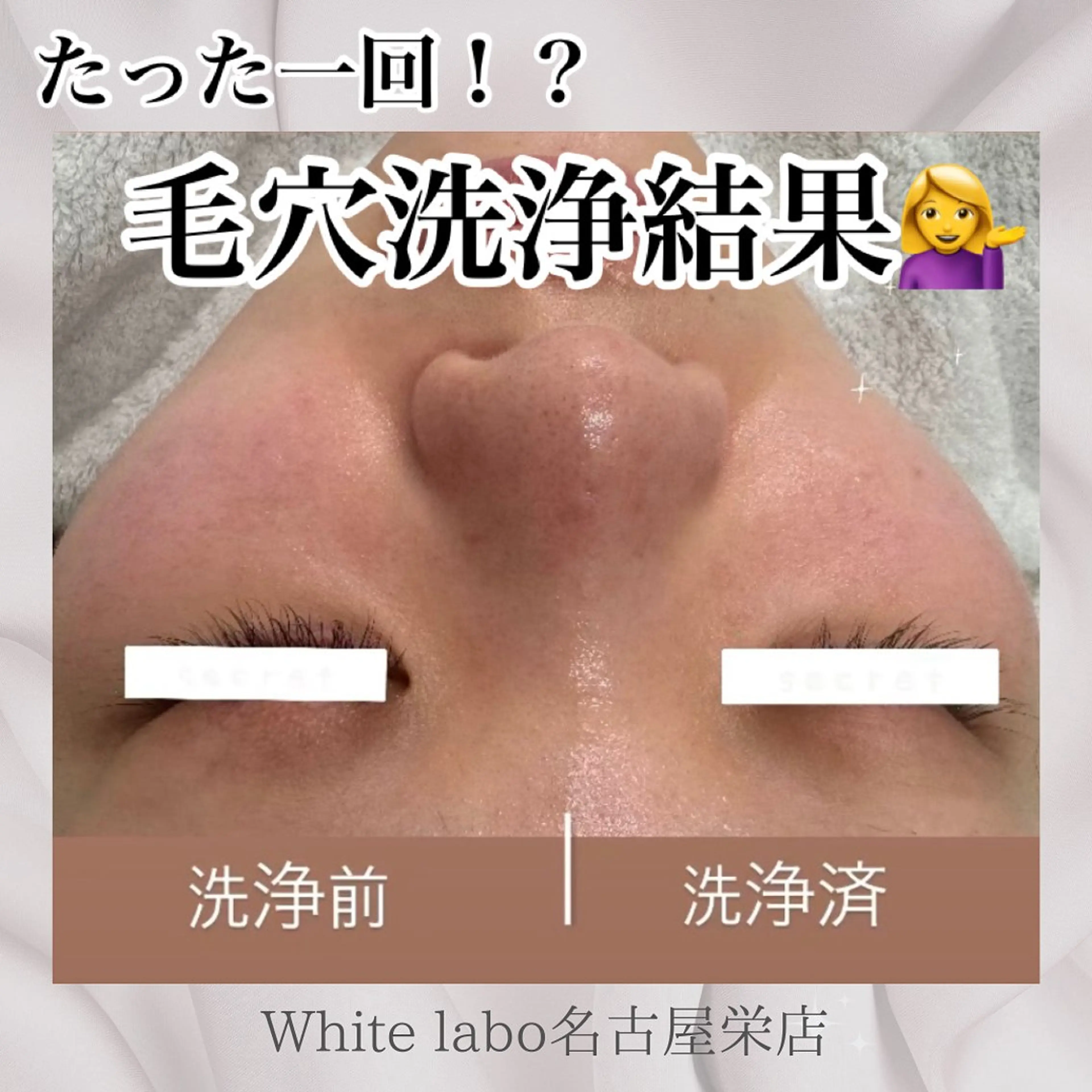 White labo 🇰🇷REIの眉毛・アイブロウイメージ