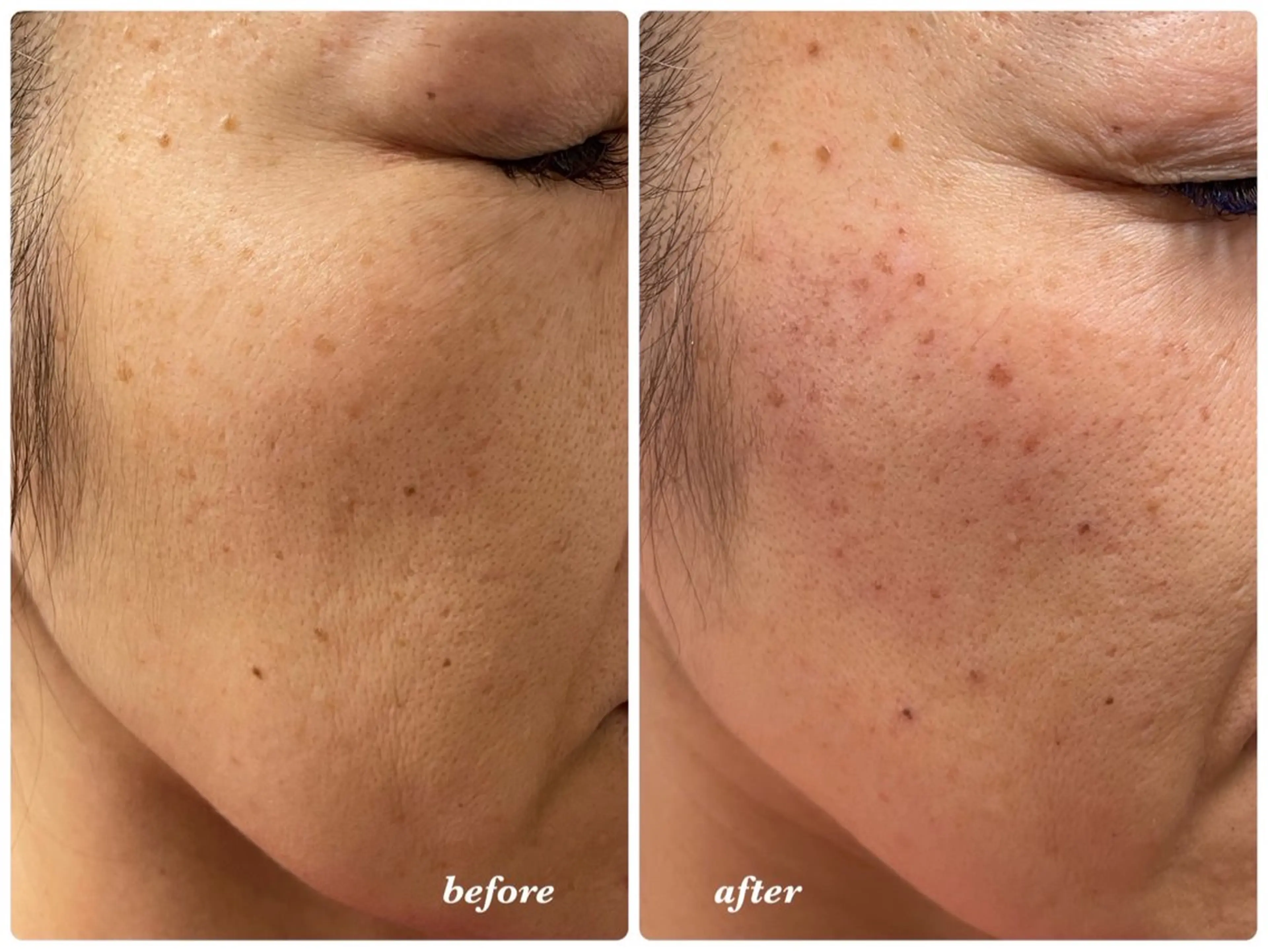 MUJIGE  ✴︎ mamiのエステ・リラクイメージ