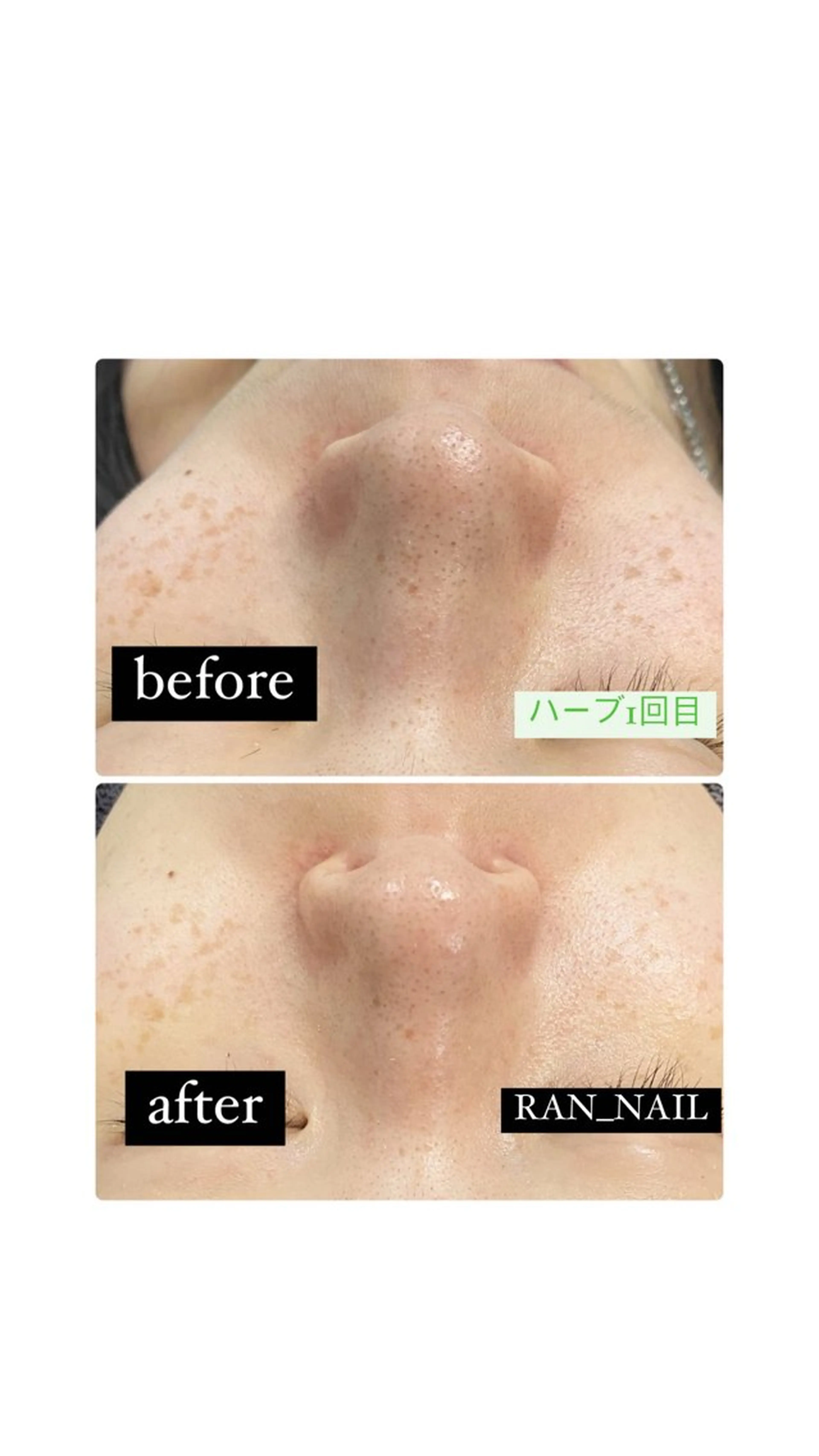 志免町 フェイスシャルエステのエステ・リラクイメージ