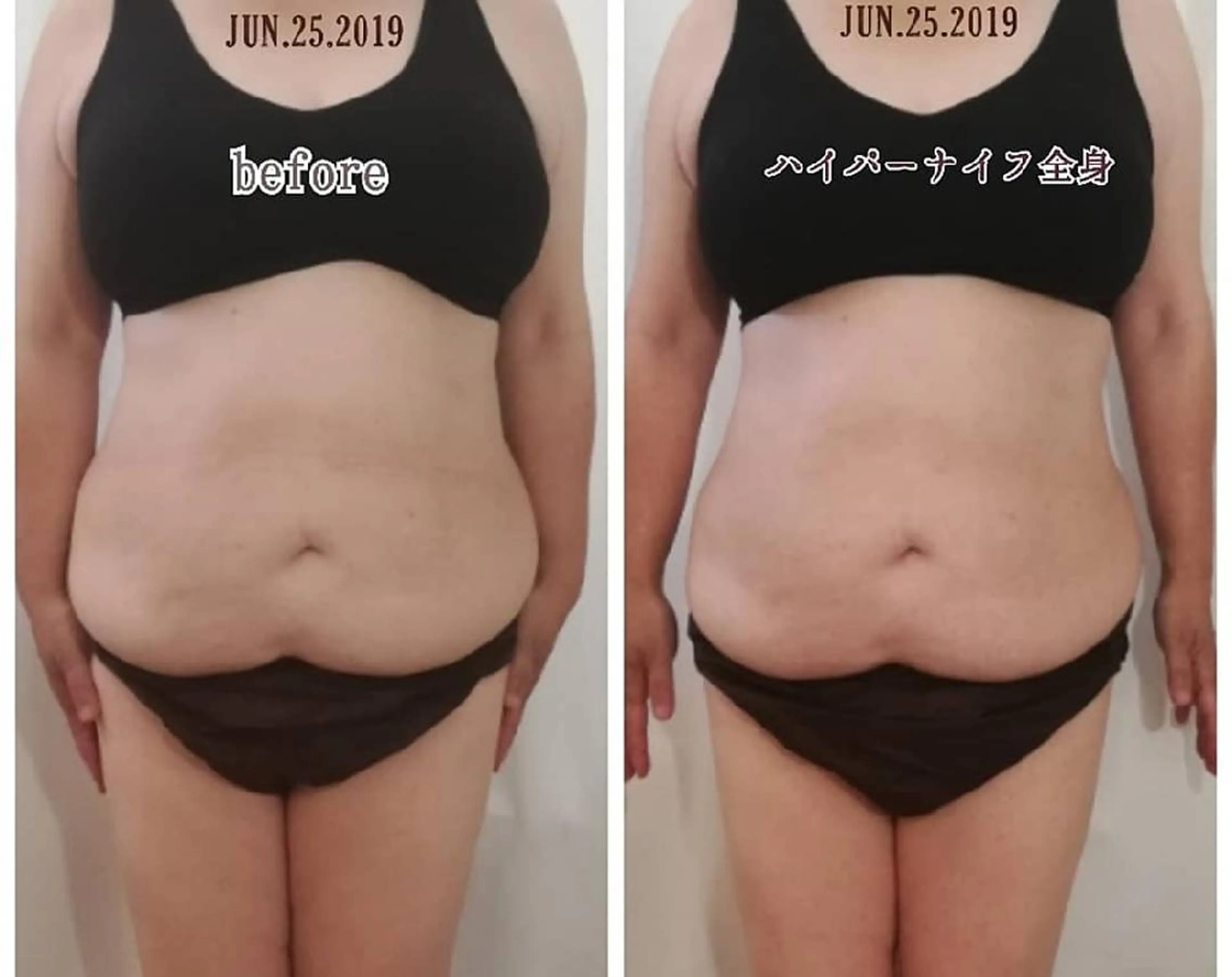 LATTE マツエク&ハイパーナイフ所属・LATTE eyelashのマツエク・マツパデザイン