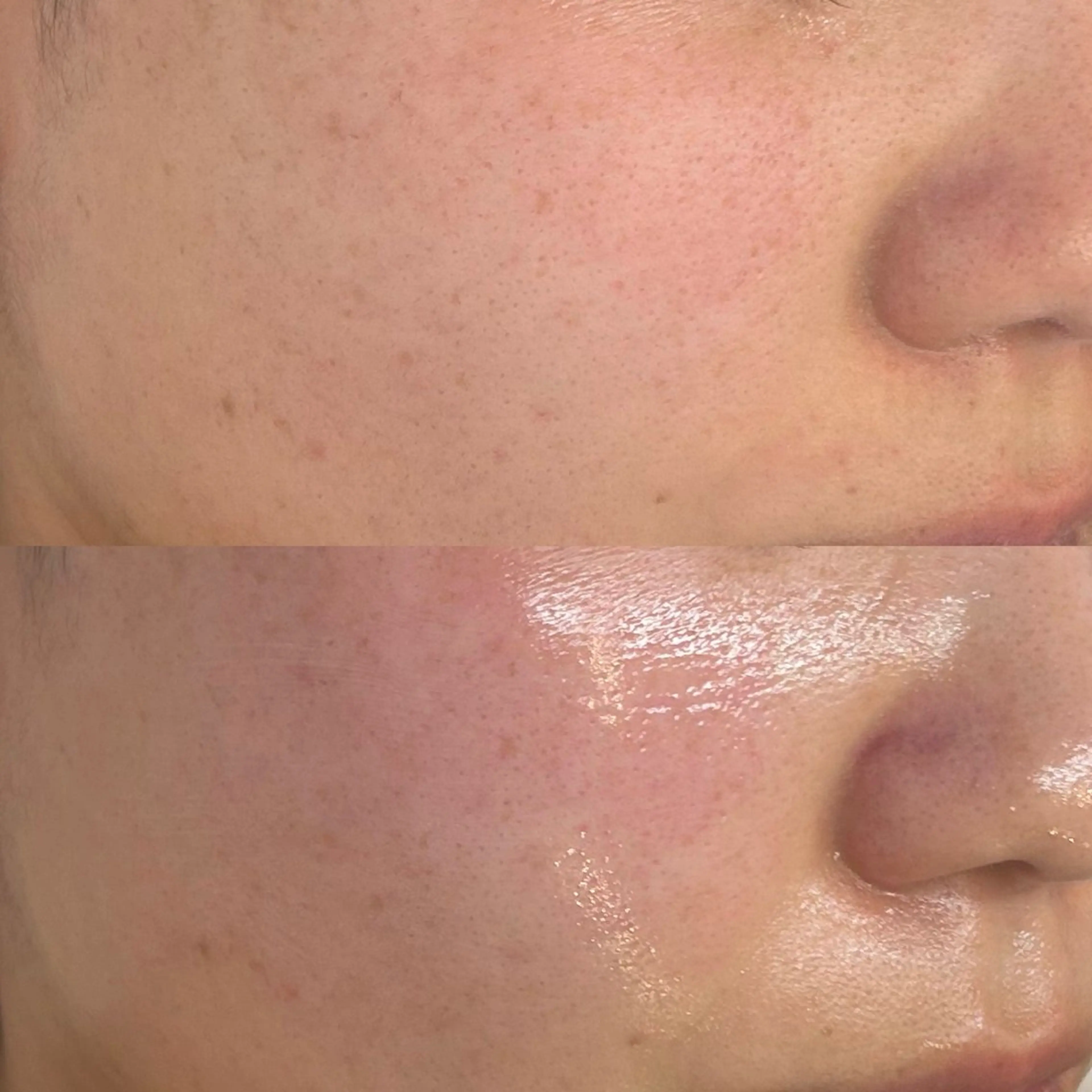 エステ 韓国🇰🇷価格 サロン_Nbibiのエステ・リラクイメージ