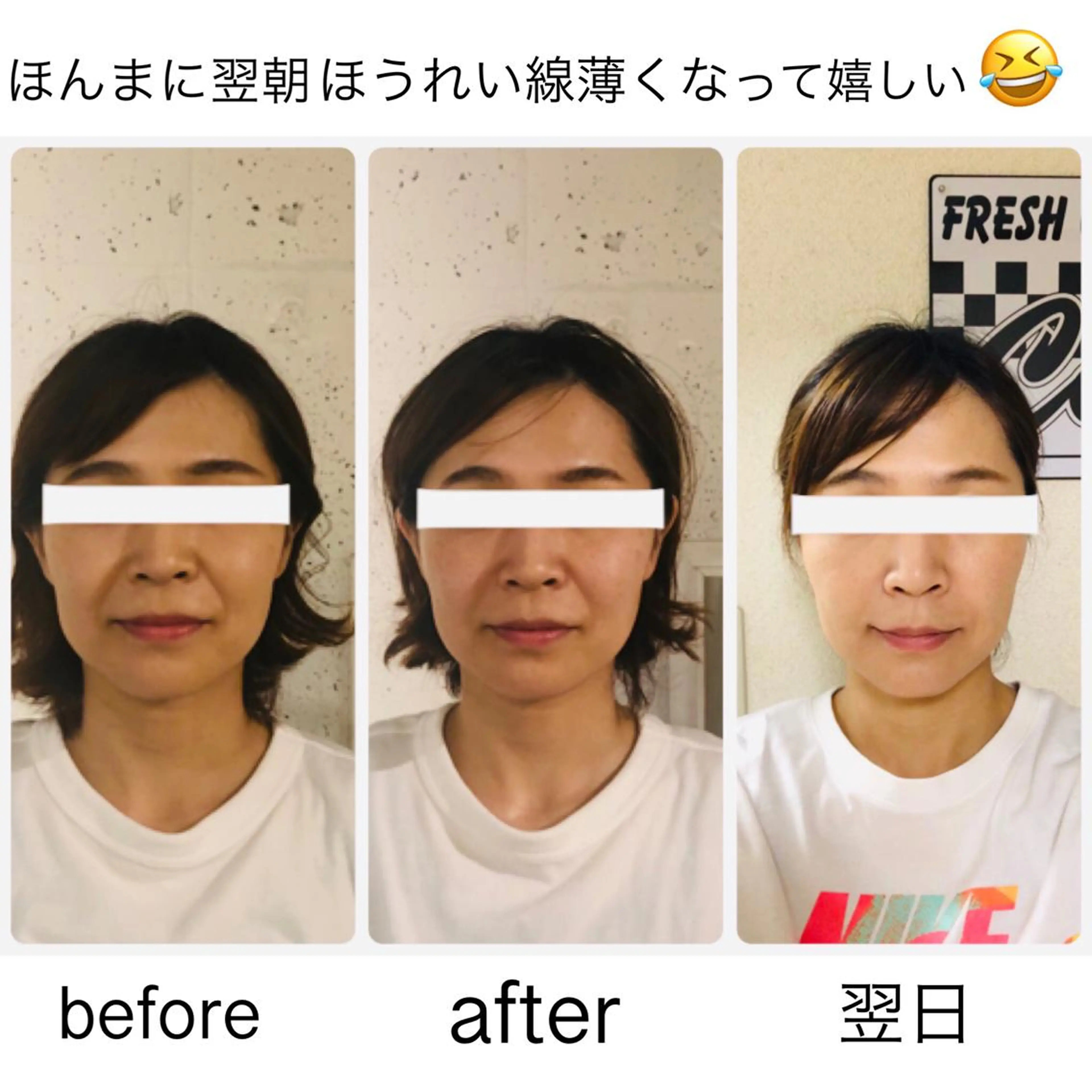 ミディアム カラー ネイル 小顔カット 小顔矯正専門サロンジュマリ所属・町田 淳子のエステ・リラクイメージ