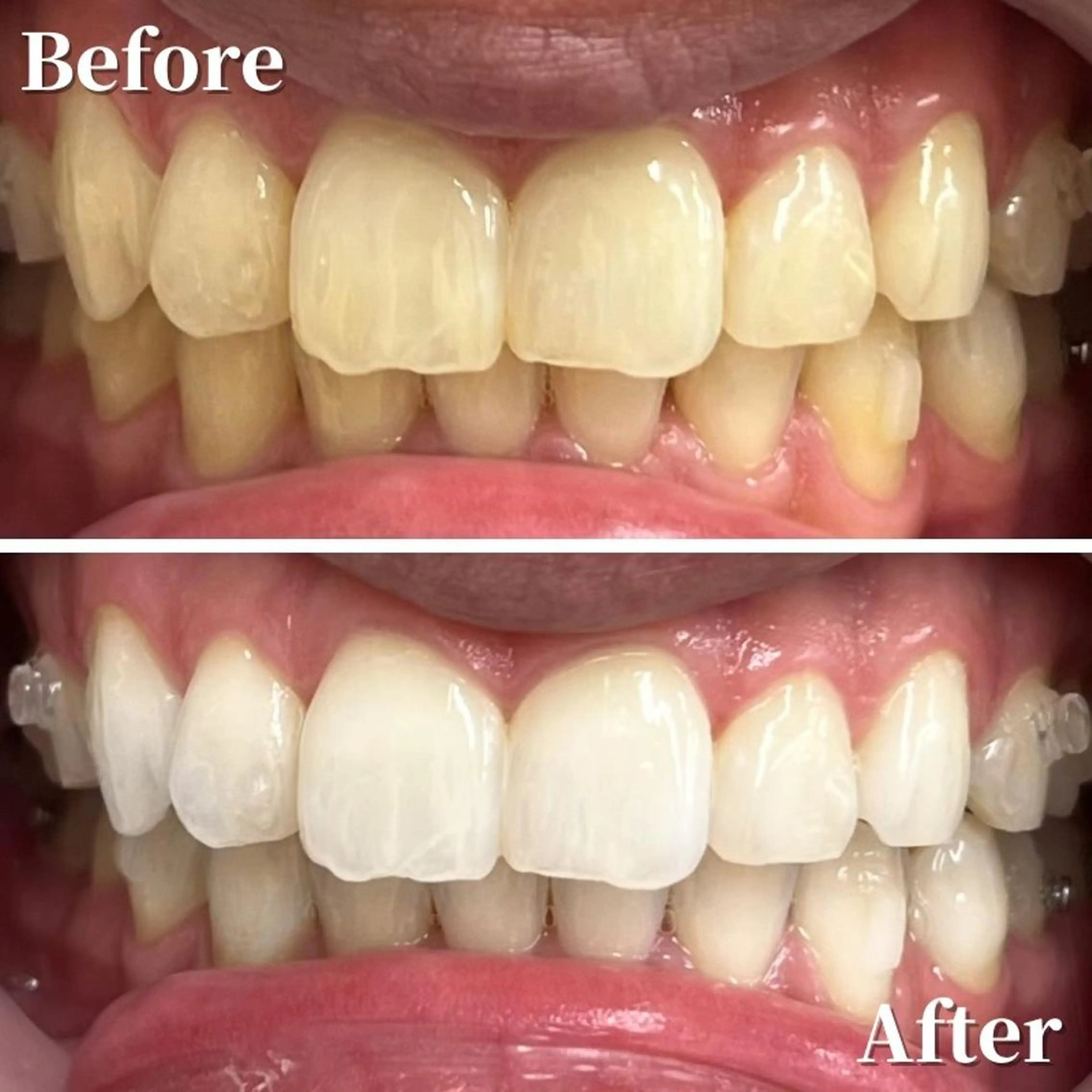 LBSホワイトニング 銀座店💎公式のその他イメージ