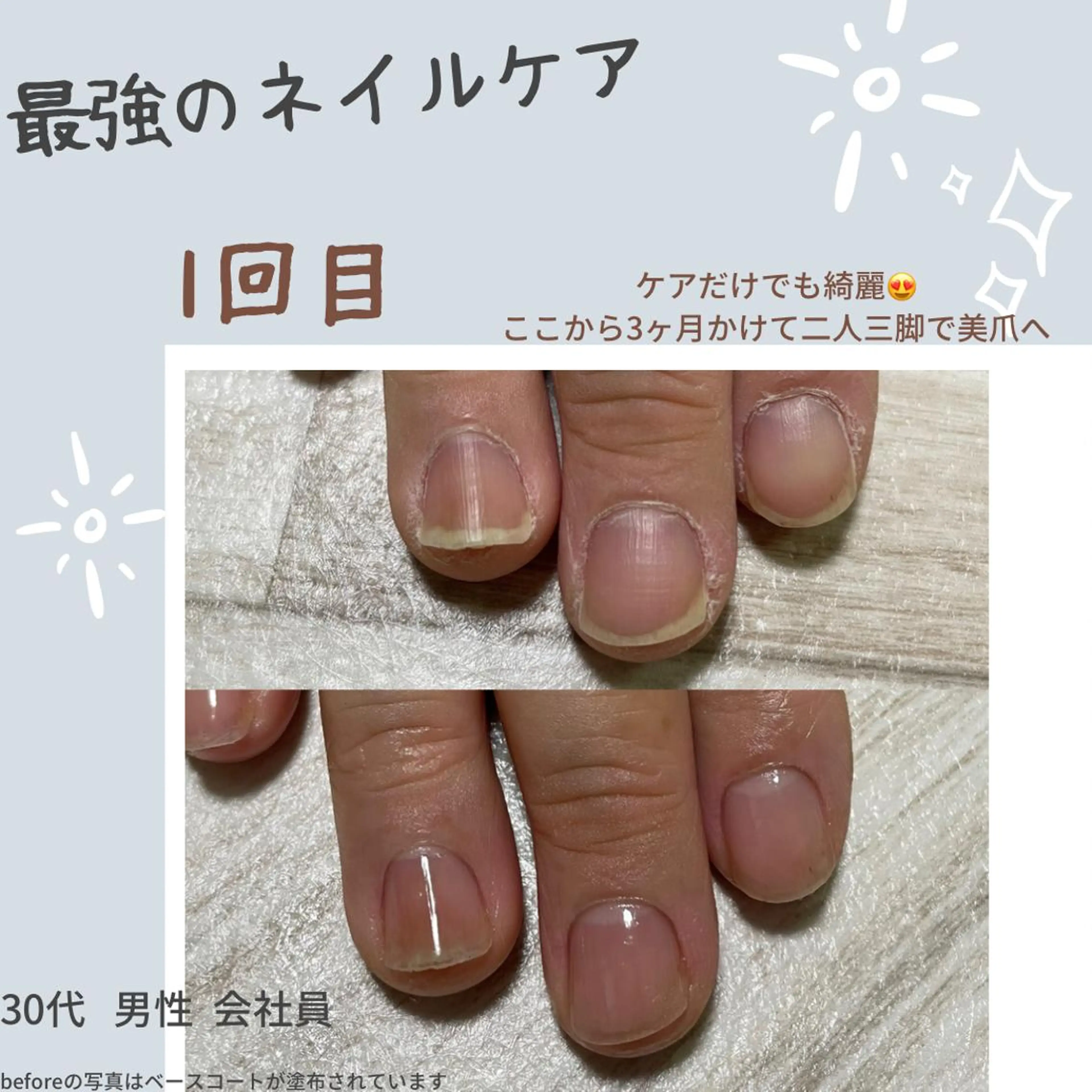 ネイル Ka pilina所属・自爪育成専門店 Kapilinaのネイルデザイン