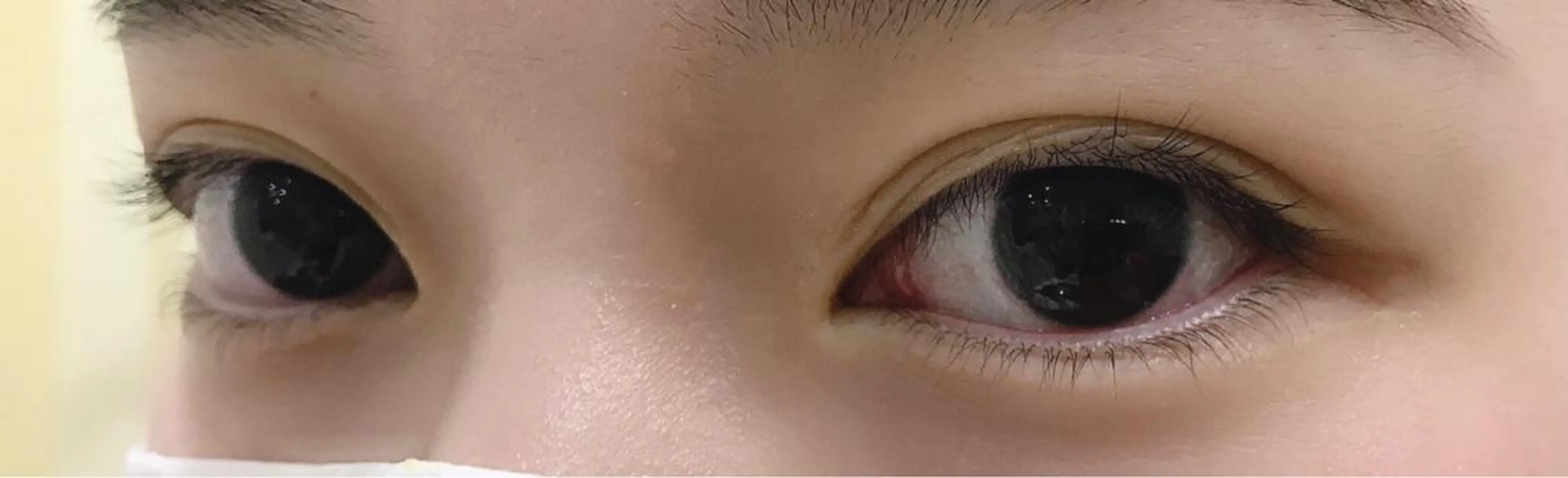 マツエク・マツパ 下まつげエクステ 一重×まつ毛パーマ REI eyelashのマツエク・マツパデザイン
