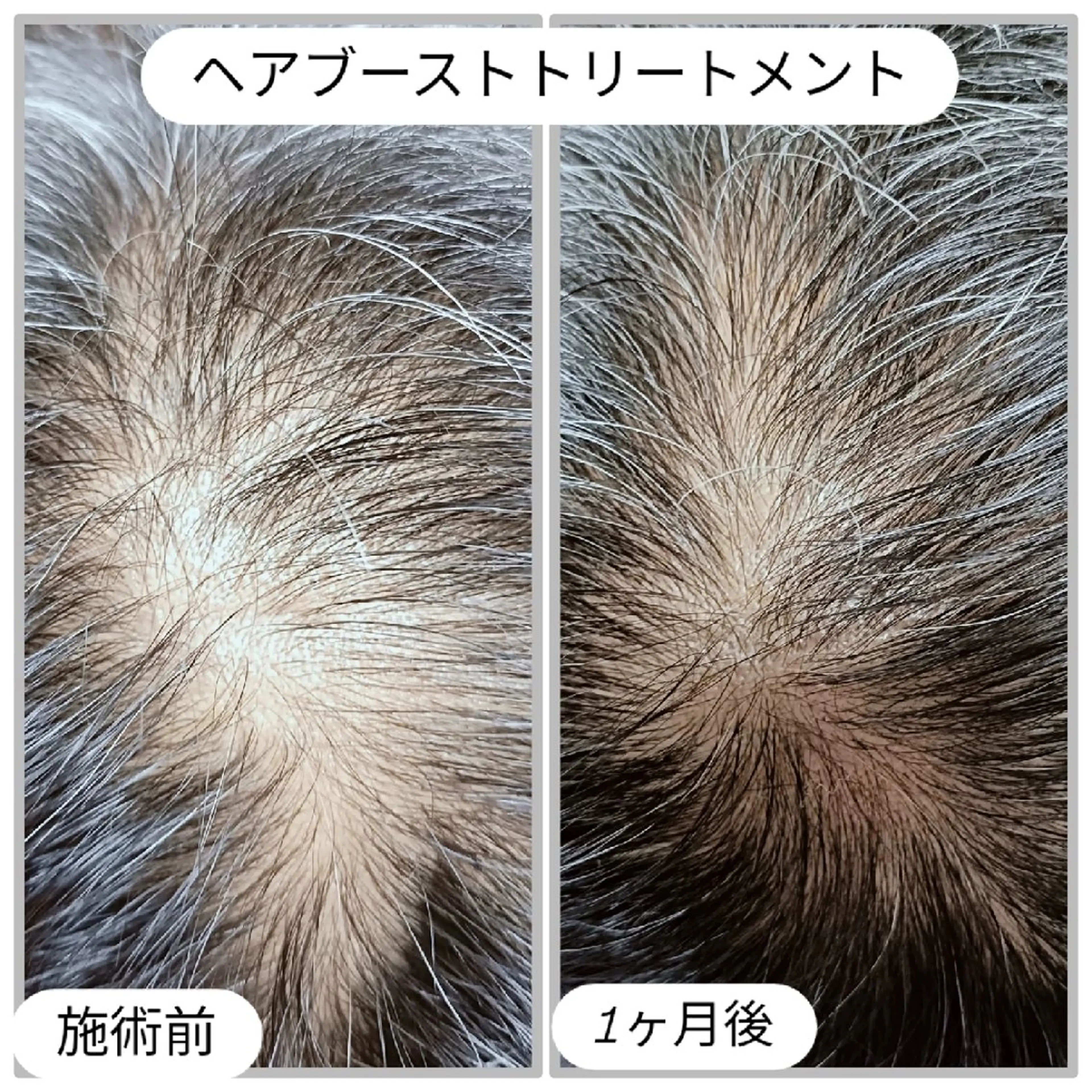 エステ リラク グリーンピール専門店 ECLAREのエステ・リラクイメージ
