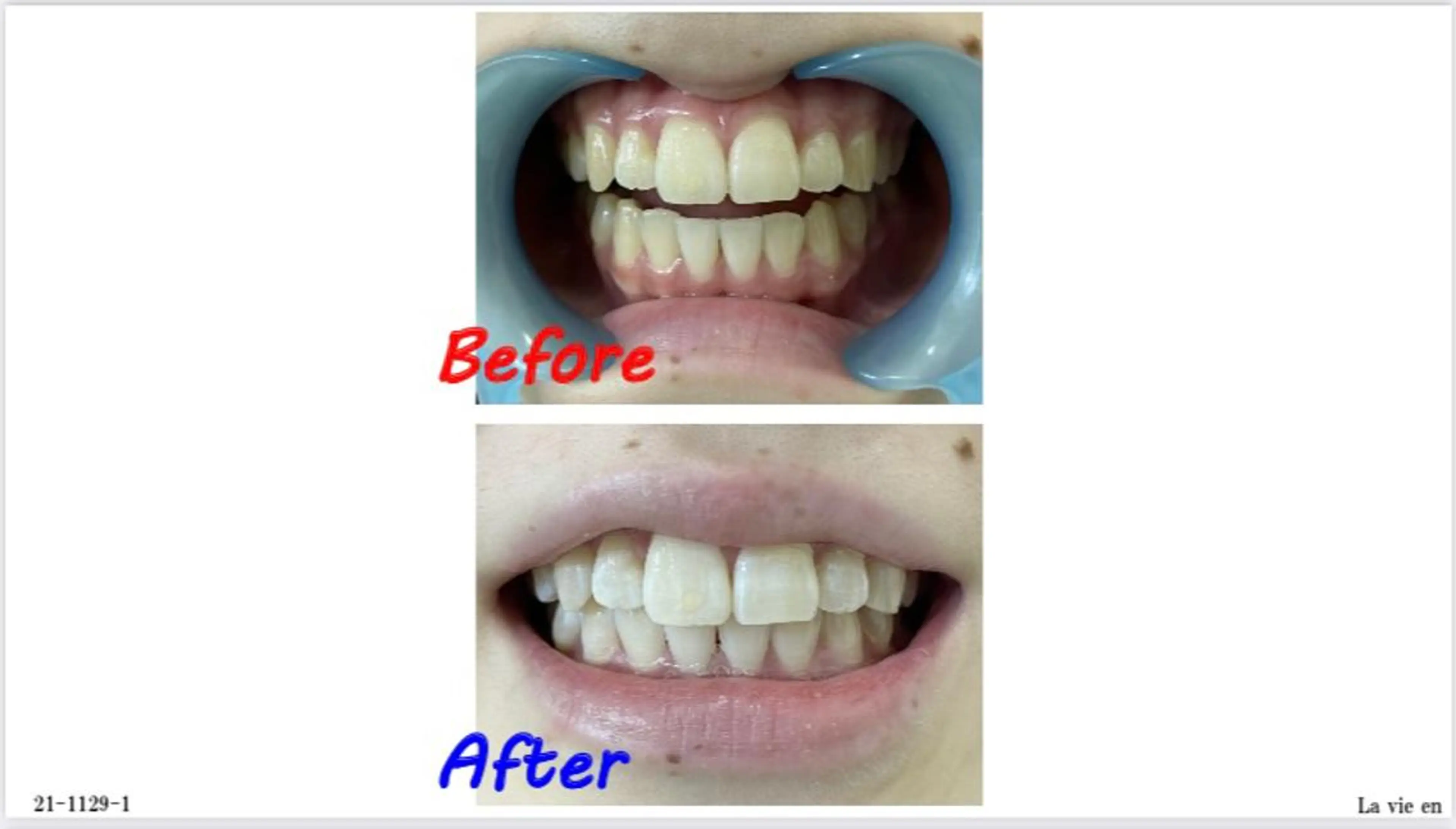 その他 セルフホワイトニングサロン　ラヴィアン所属・ホワイトニングサロン La vie enのその他イメージ