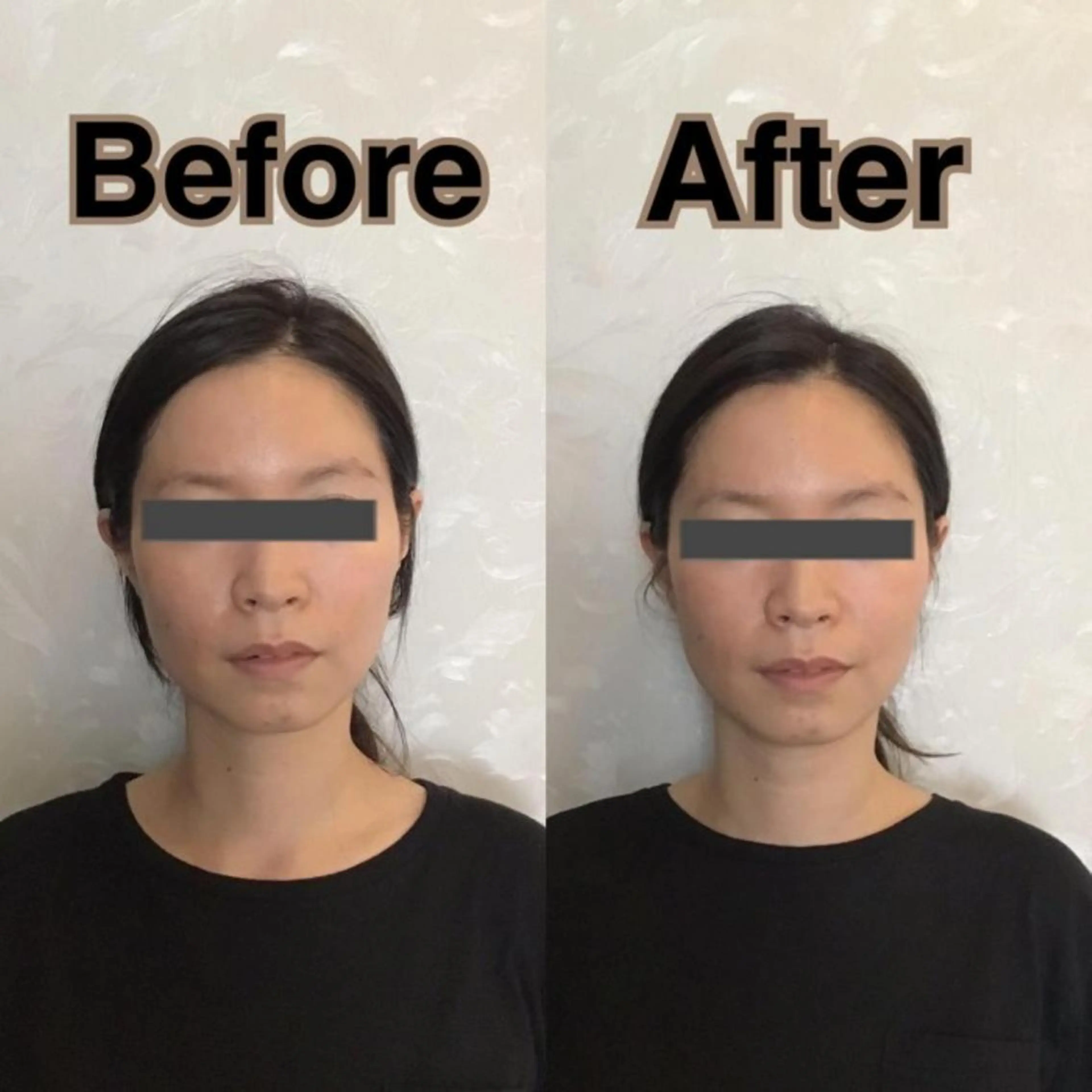 姿勢・骨盤/小顔矯正 痩身ダイエット 横田のエステ・リラクイメージ