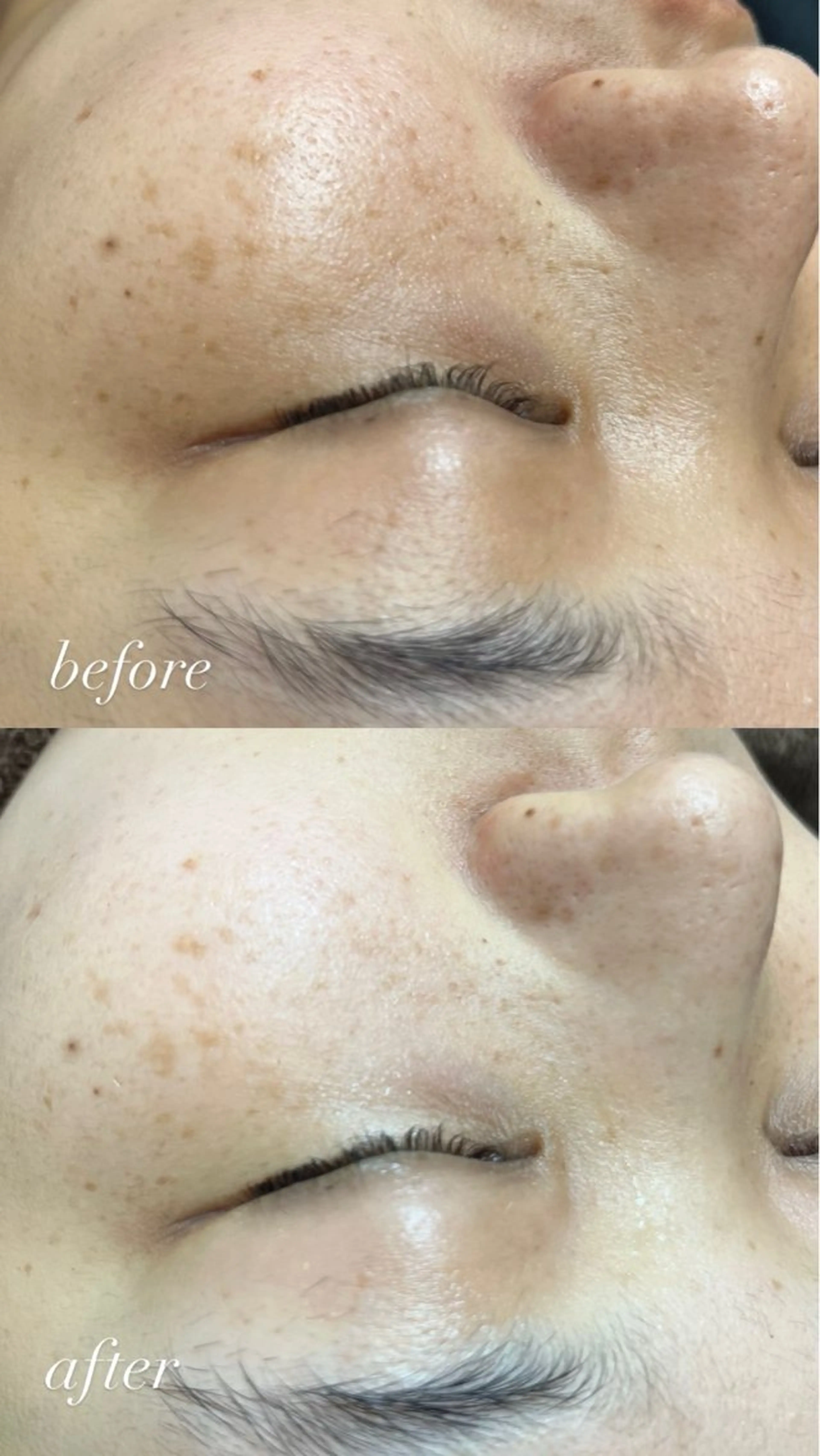 エステ smile nail スマイルネイルのその他イメージ