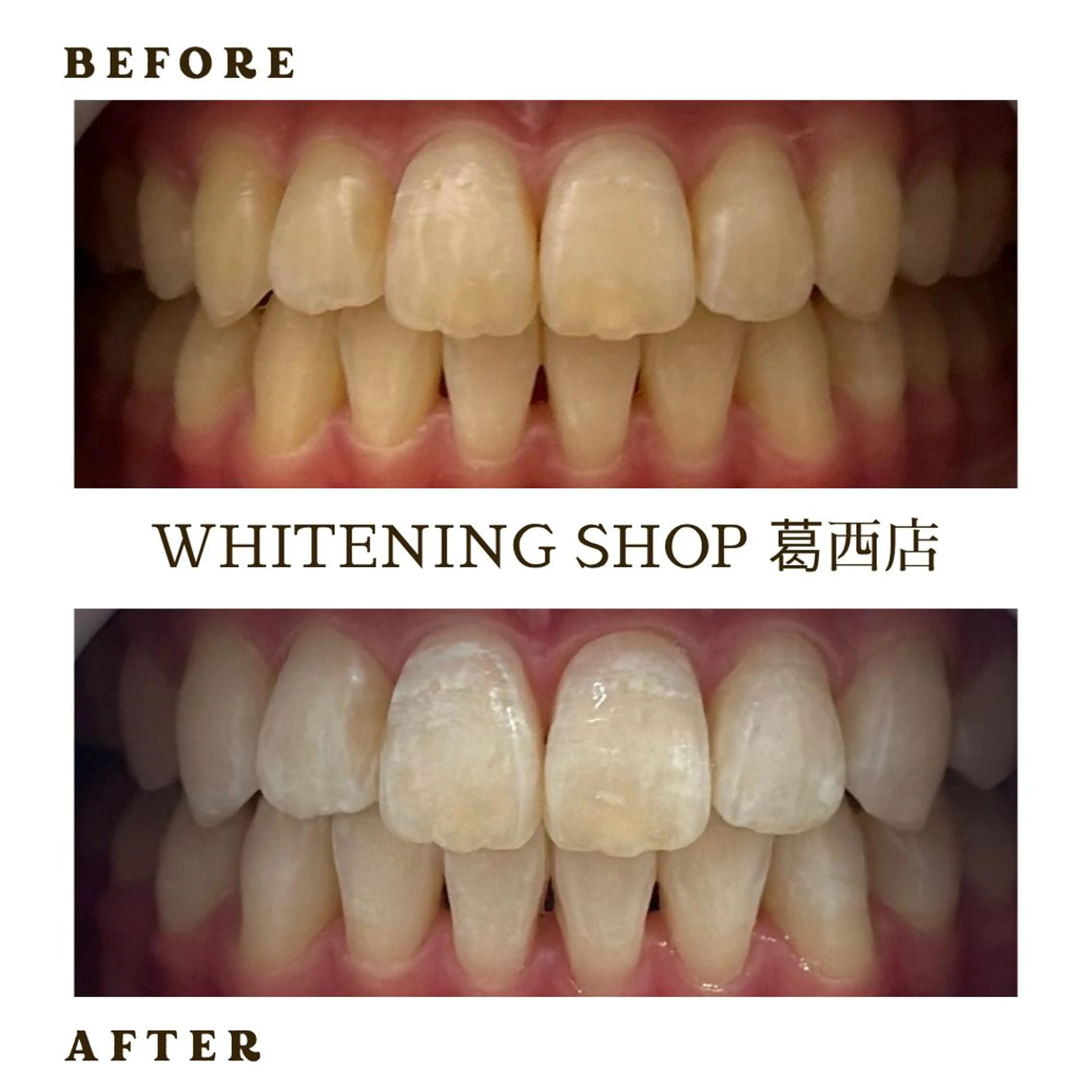 メンズ その他 ホワイトニング ショップ葛西店のその他イメージ