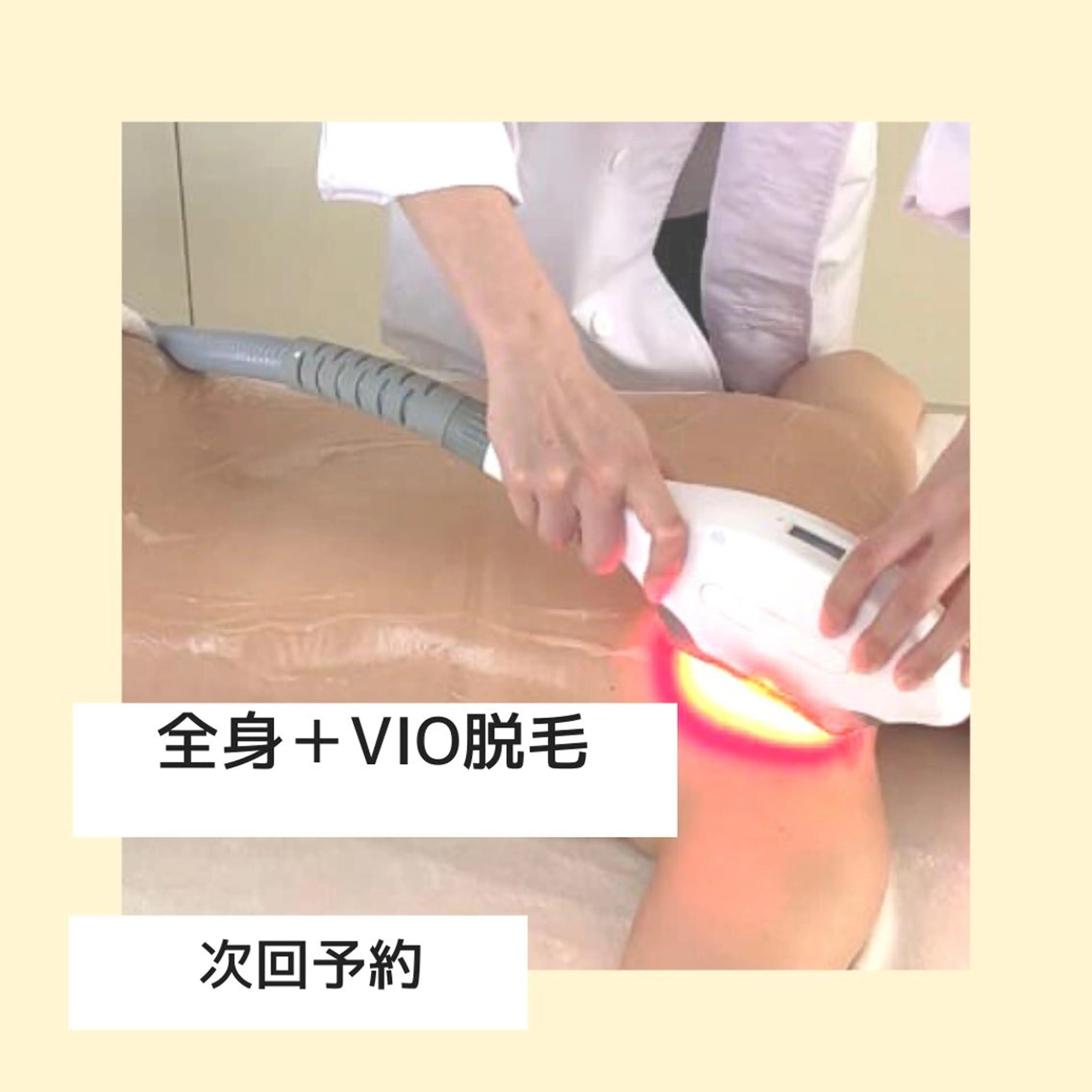 20代から始める脱毛 salonLEPIAのエステ・リラクイメージ