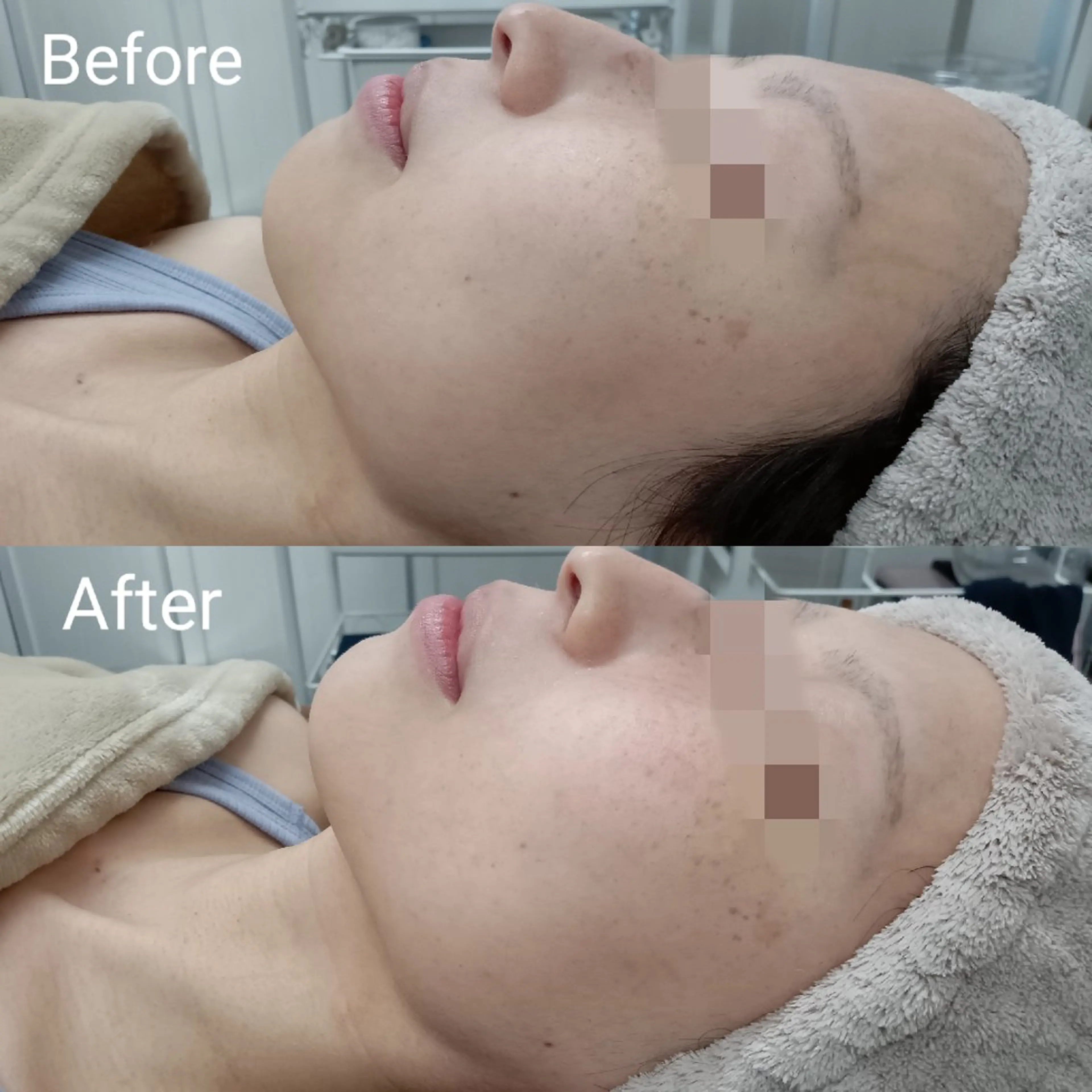 肌質改善Beauty salon Renのエステ・リラクイメージ