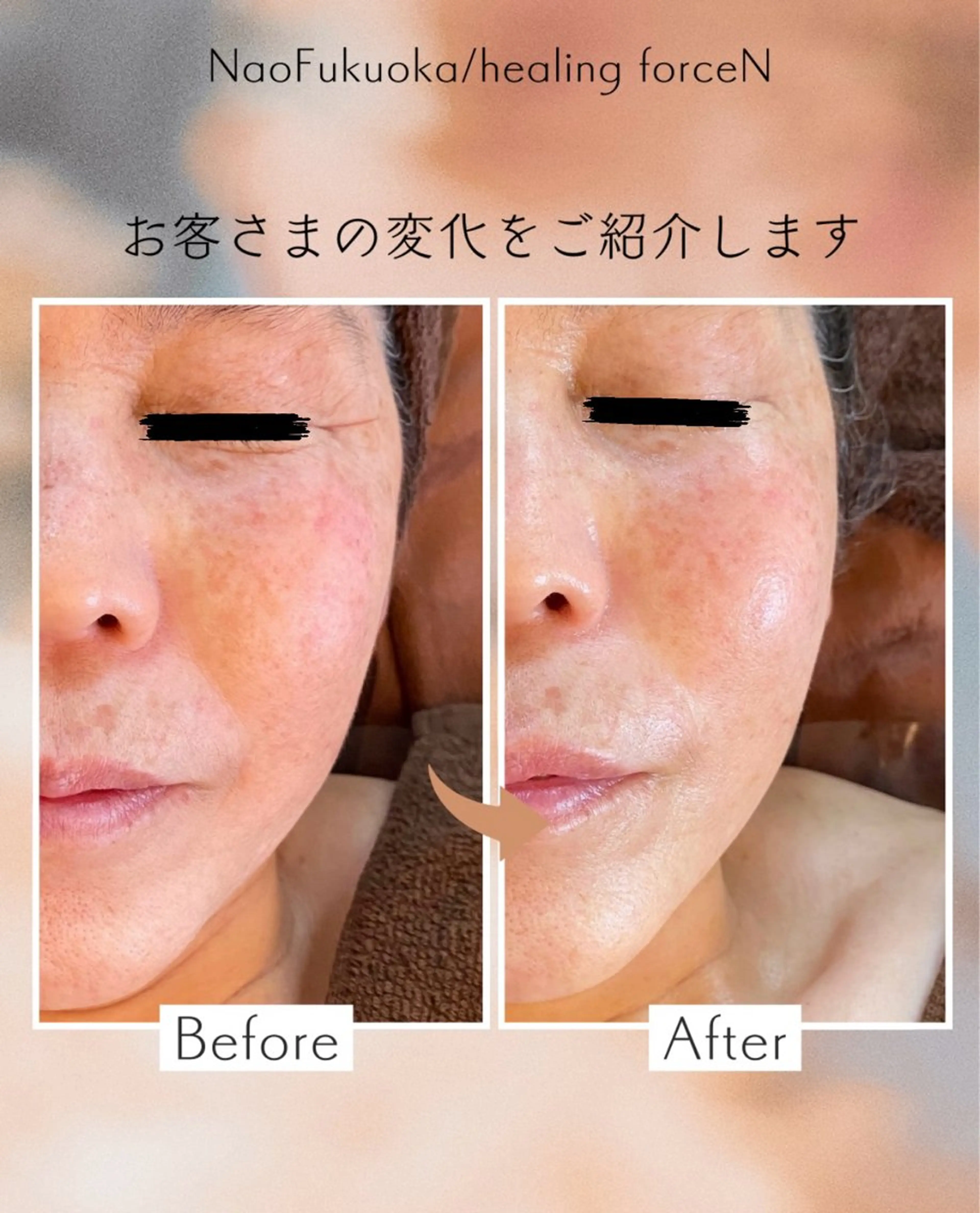 Nao Fukuoka/healingforceN所属・野中 康子のエステ・リラクイメージ