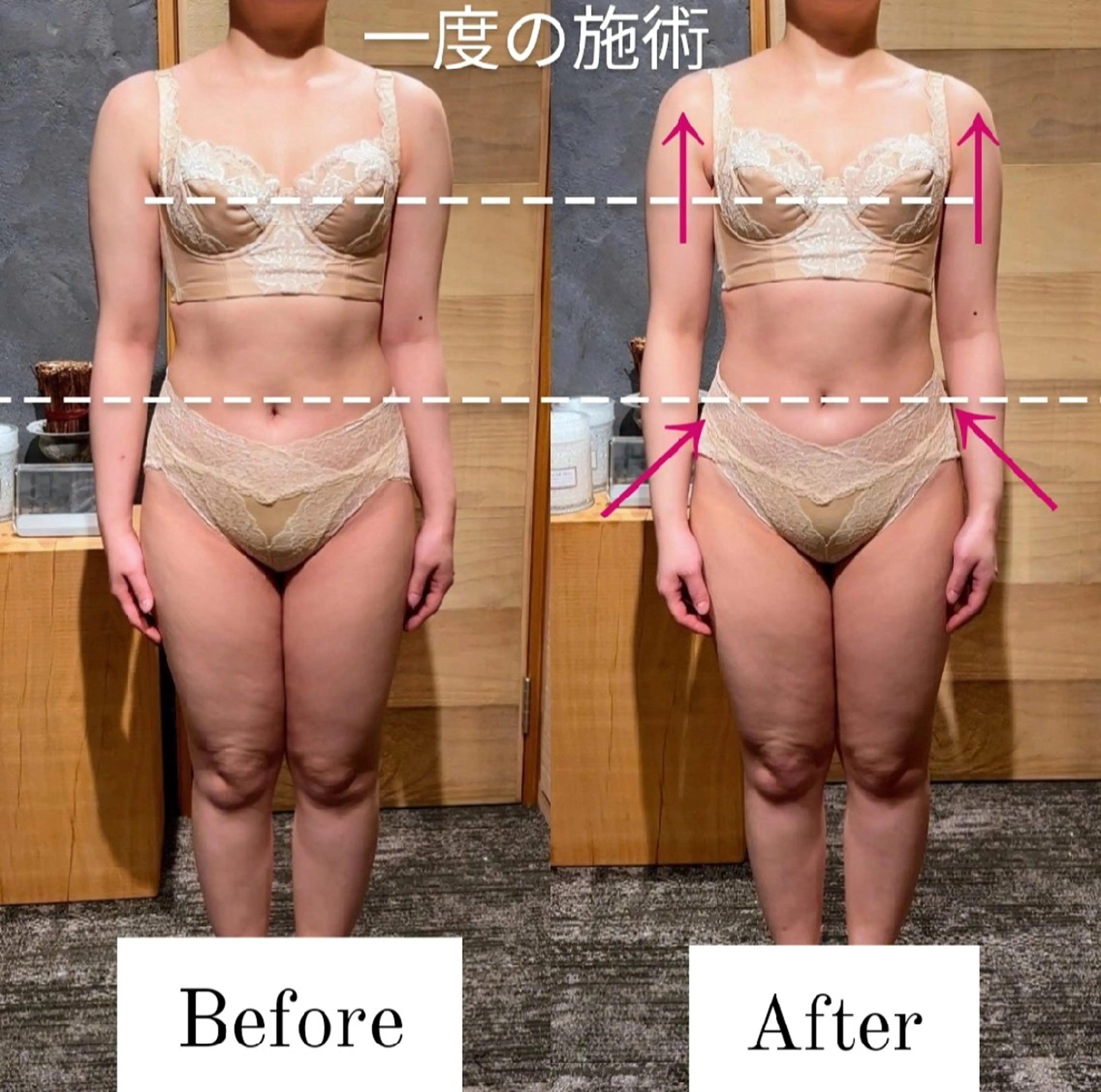 エステ リラク 深層リンパの癒し 美姿勢×痩身✨のエステ・リラクイメージ