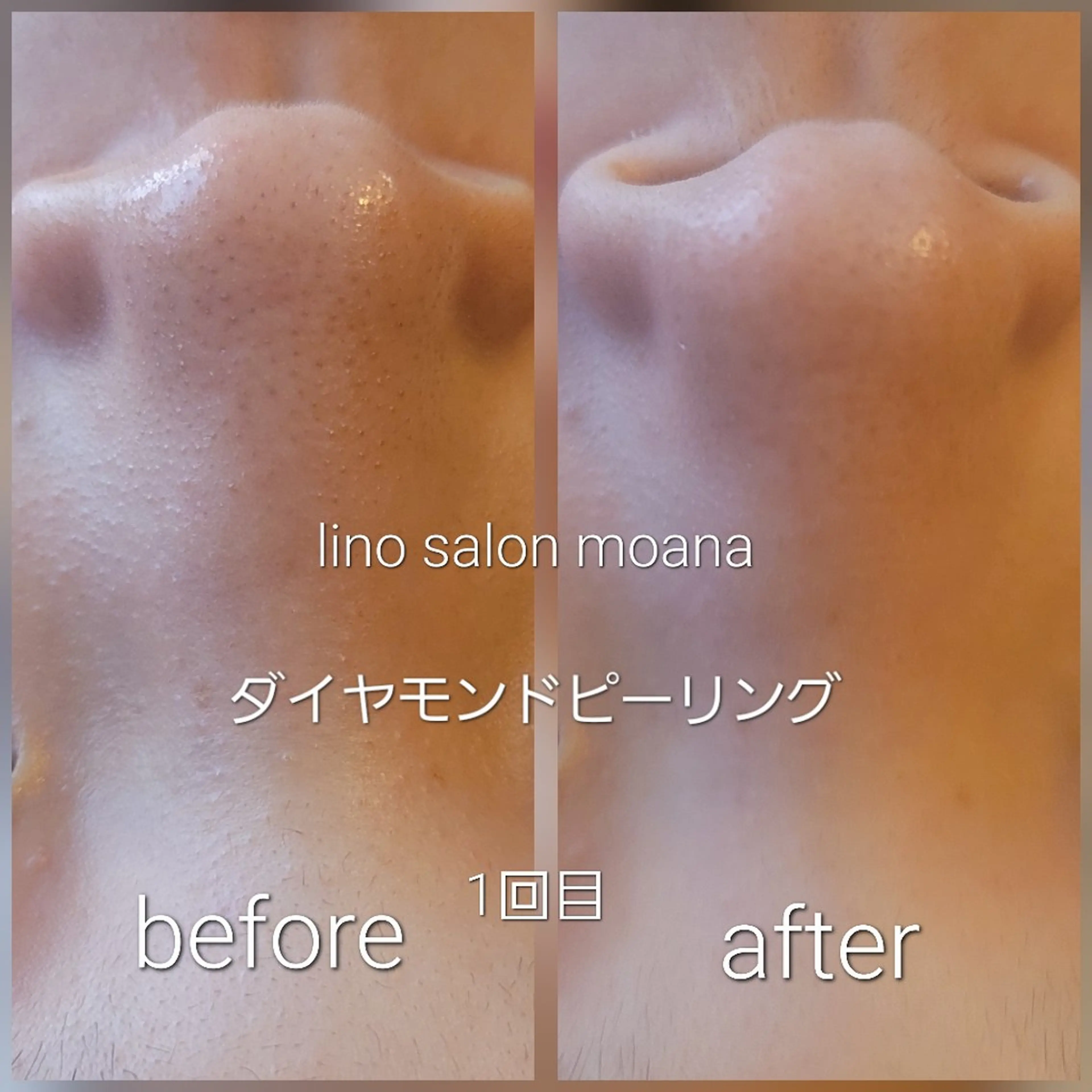 lino salon moana所属・lino salon  moanaのエステ・リラクイメージ