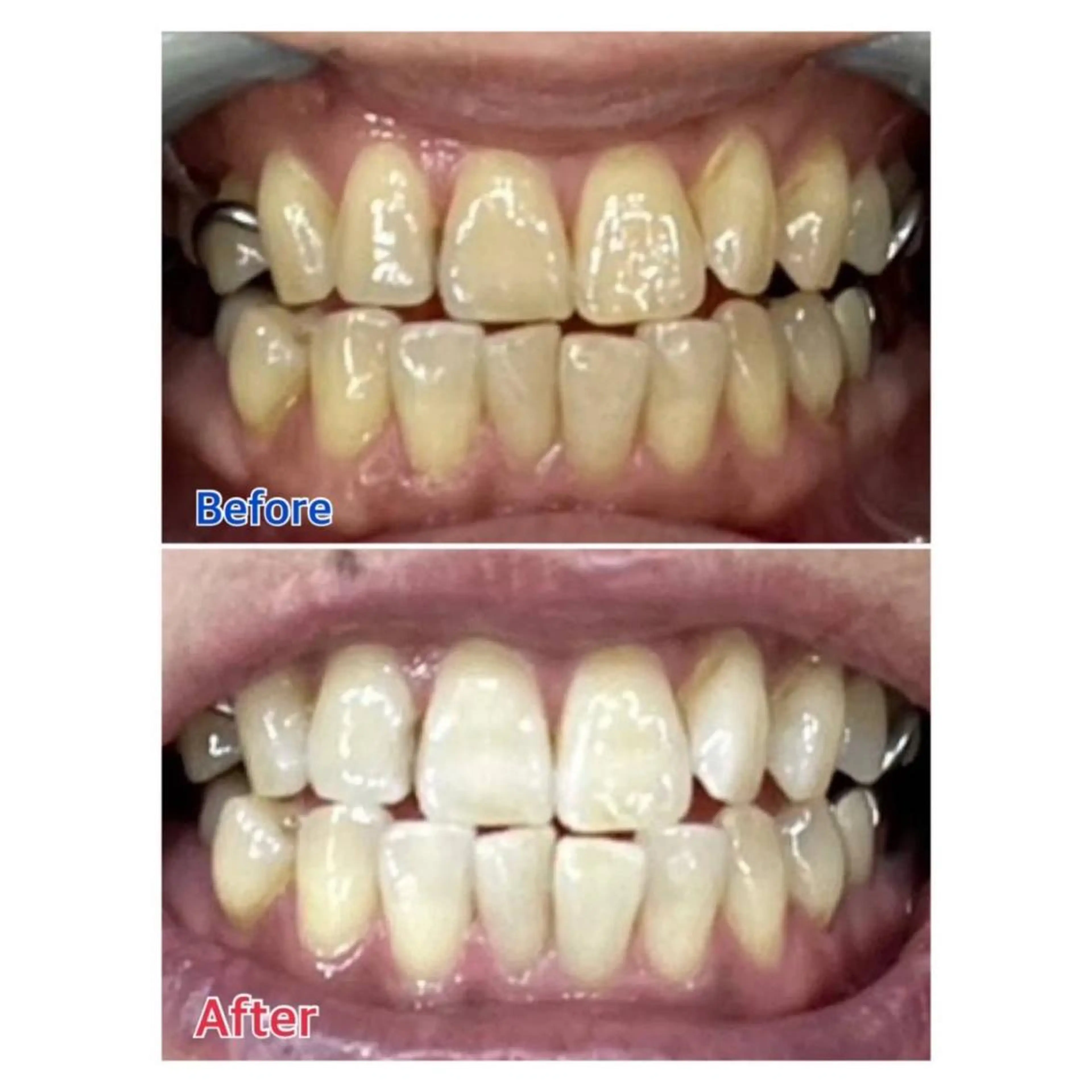 MBEAUTYSALON 千葉店・京成大久保所属・Melty 輝のその他イメージ