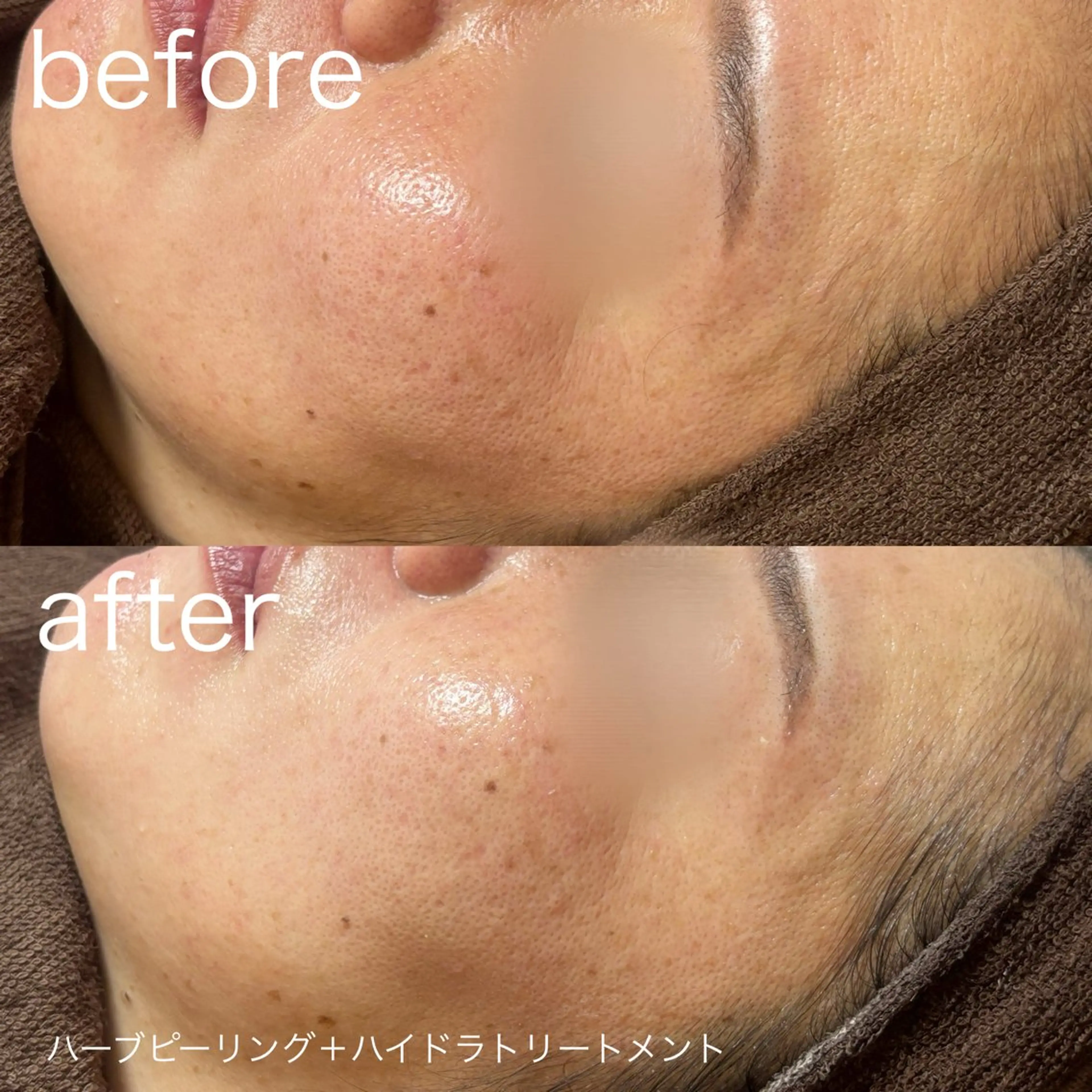 その他 lulularico Yuのエステ・リラクイメージ