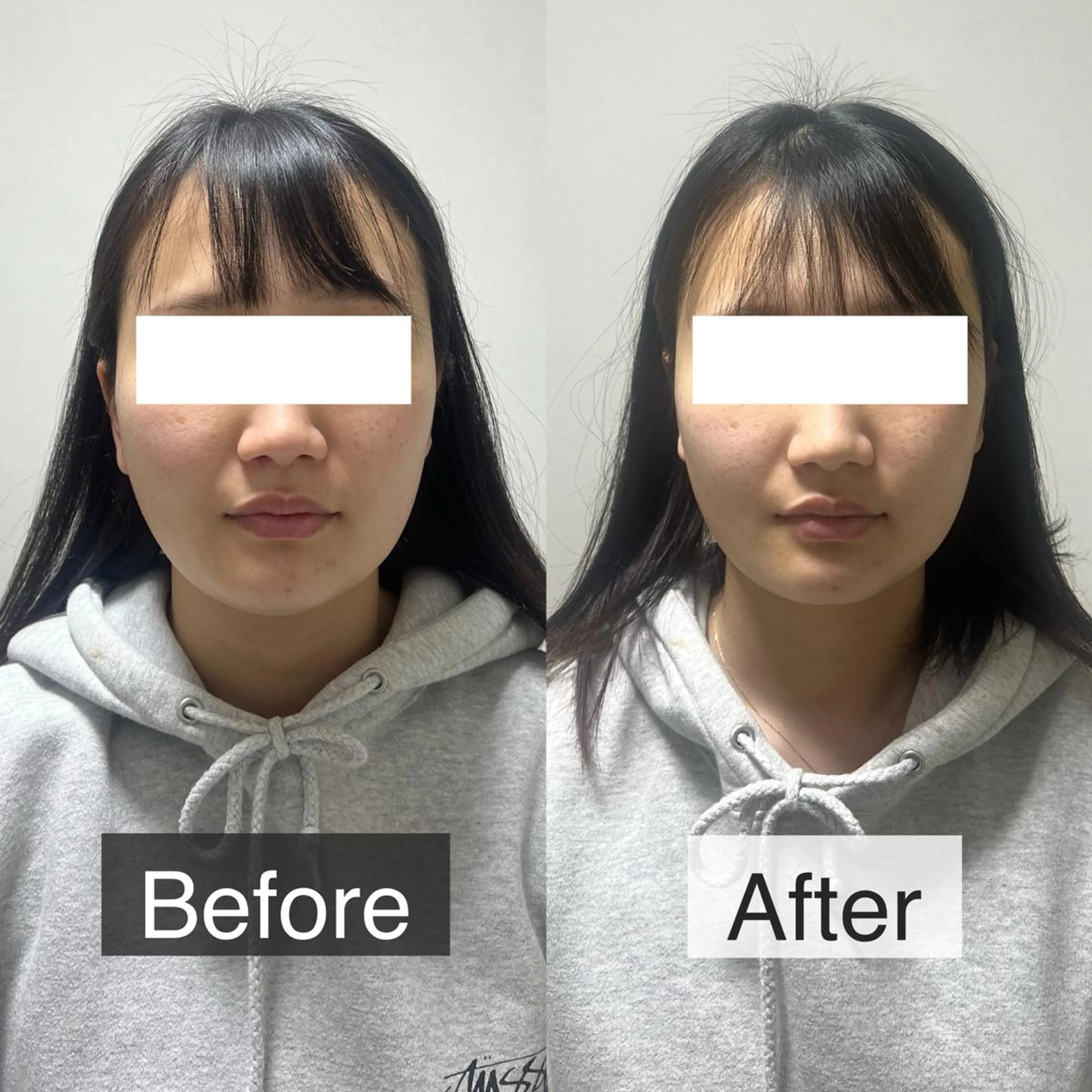 脱毛専門サロン BELFINE恵比寿のエステ・リラクイメージ