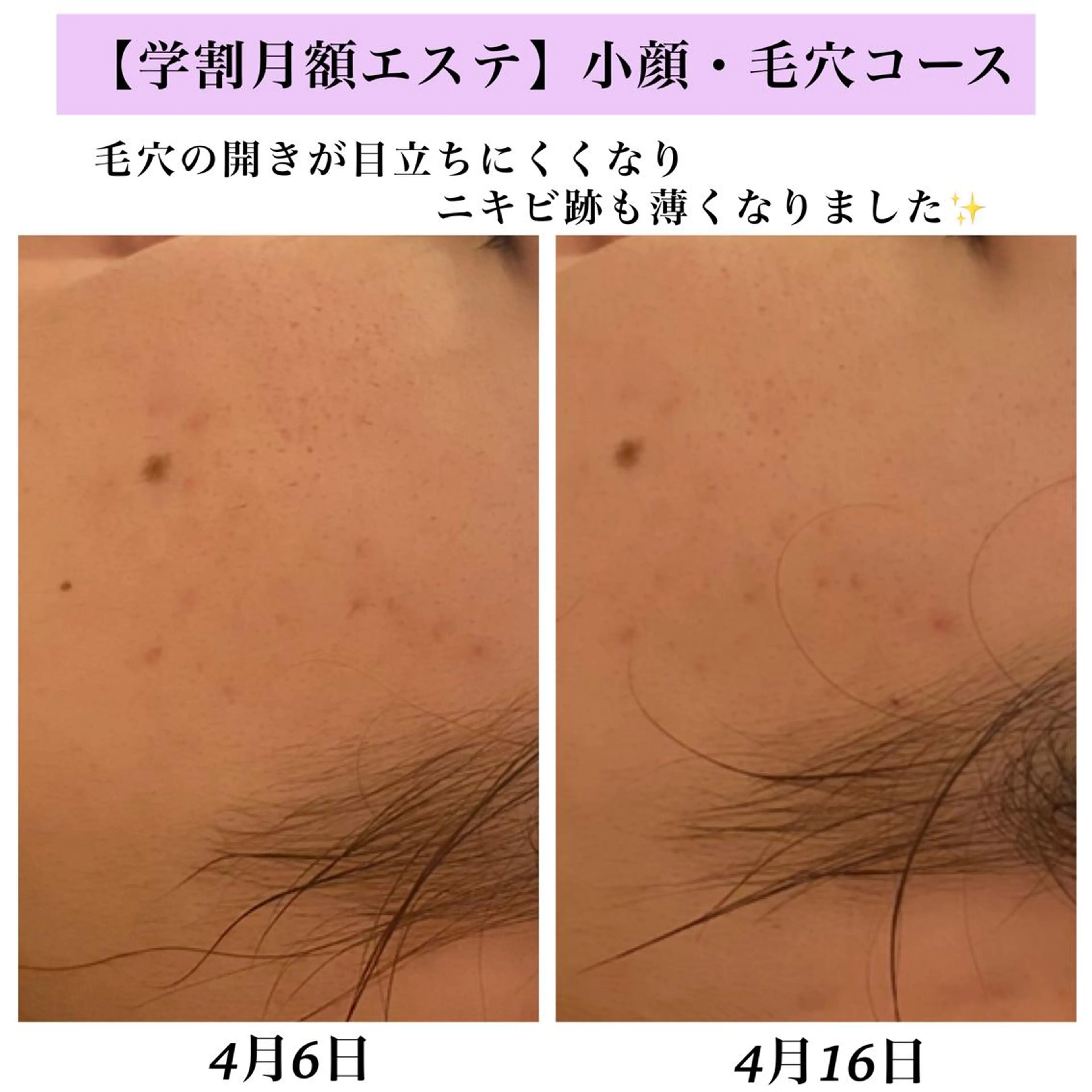 Bellesthe （ベルエステ）のエステ・リラクイメージ