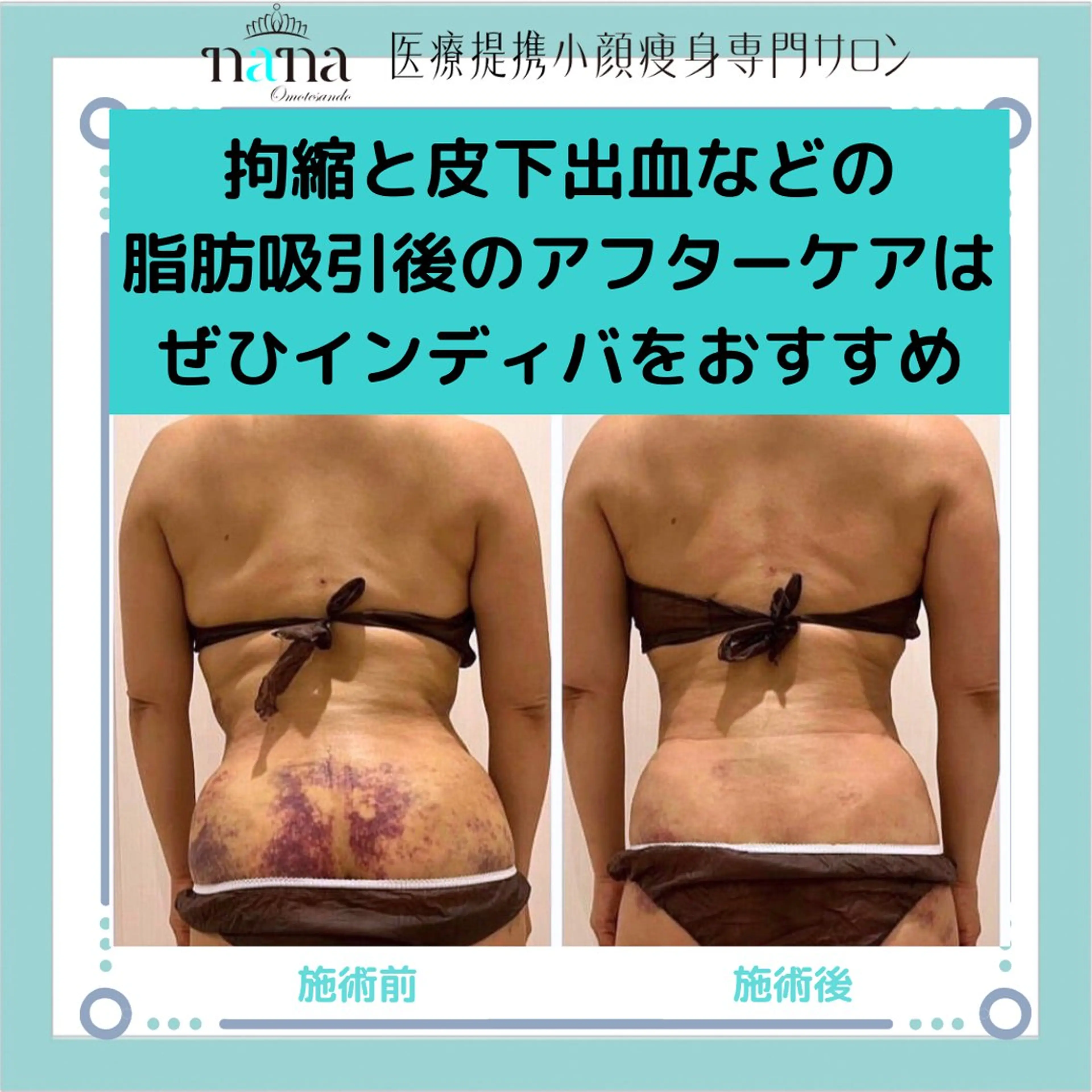 エステ リラク 小顔痩身インディバ Nana表参道のエステ・リラクイメージ