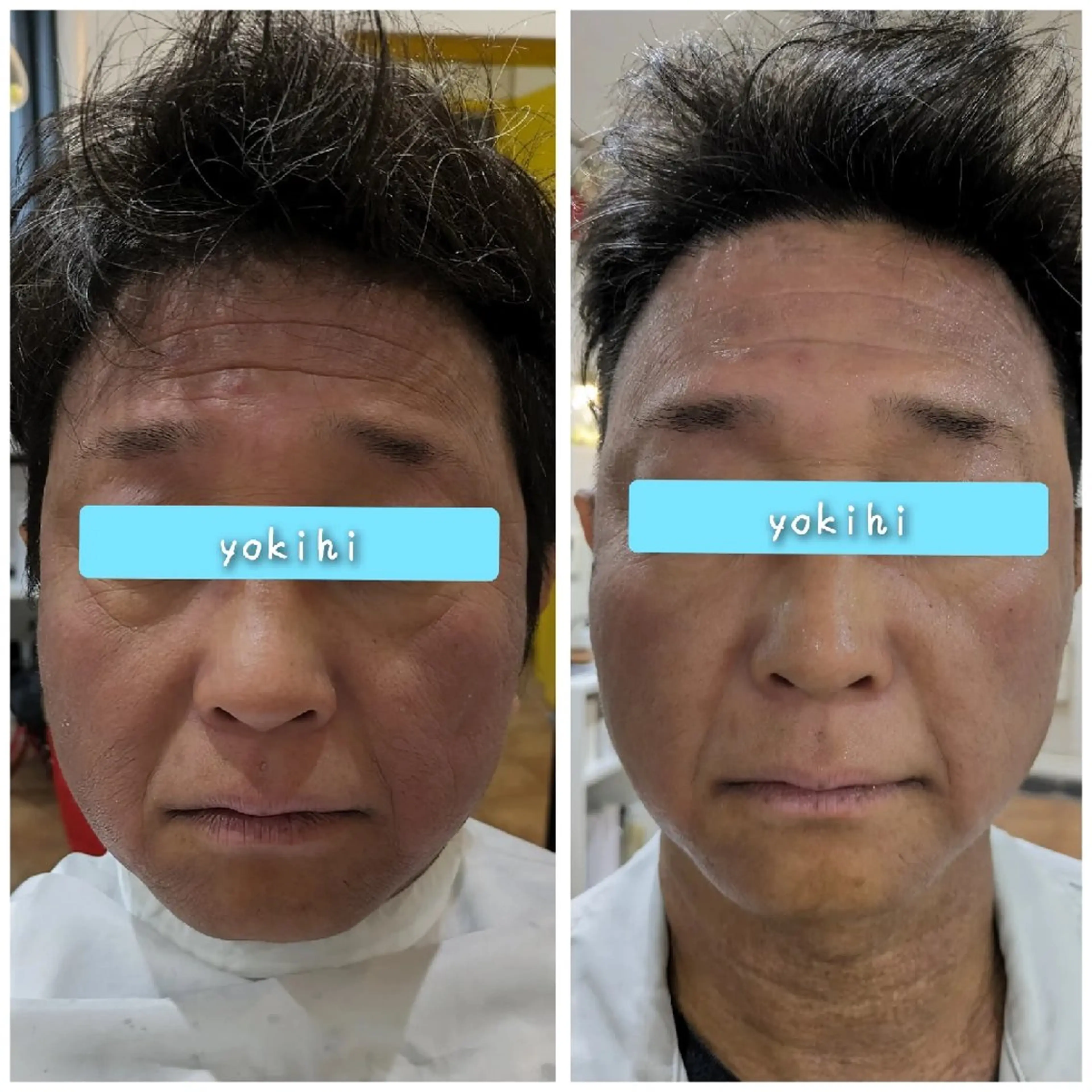艶肌松ヤニパック◎ 毛穴★ラッシュリフトのエステ・リラクイメージ