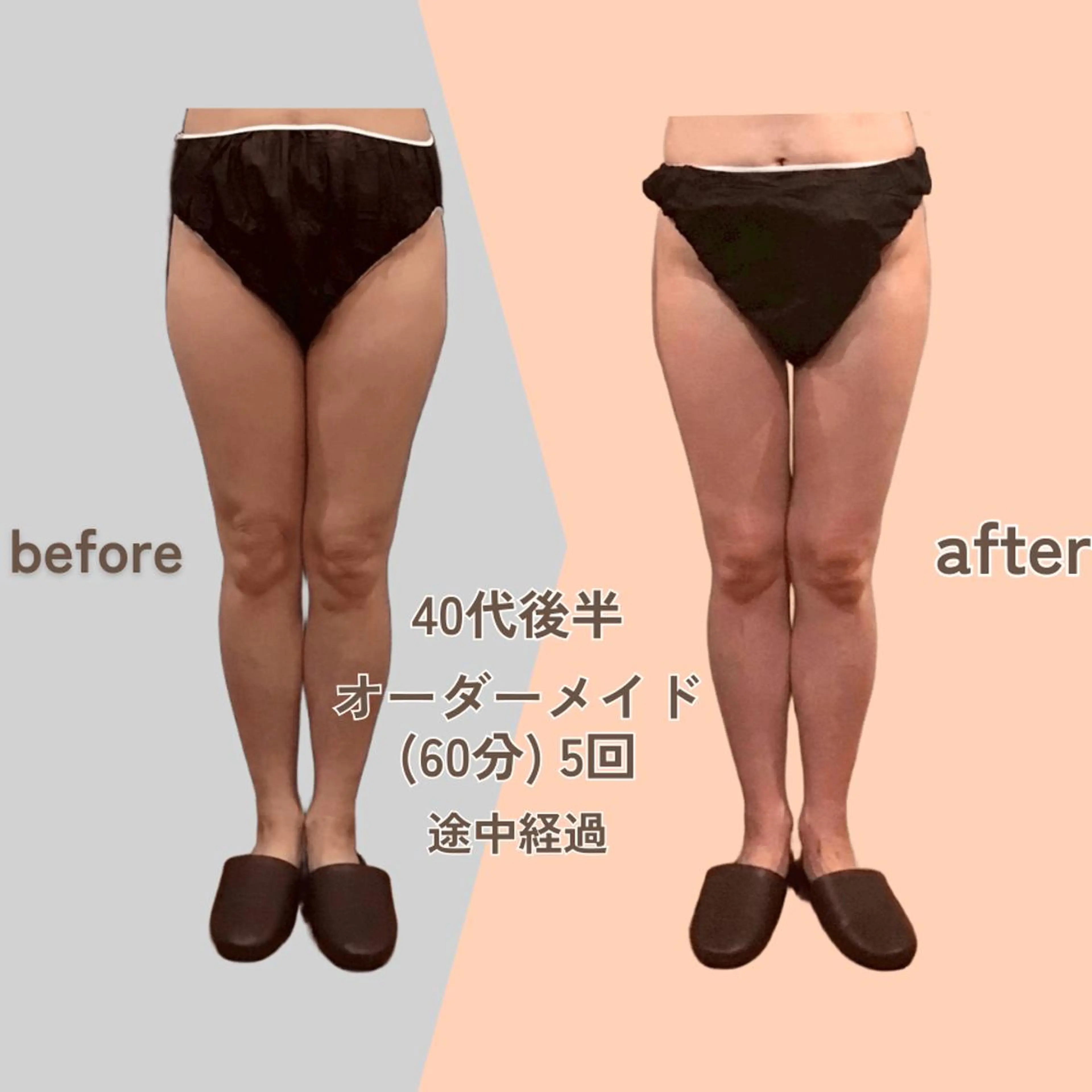 痩身エステ Julien麹町店のエステ・リラクイメージ