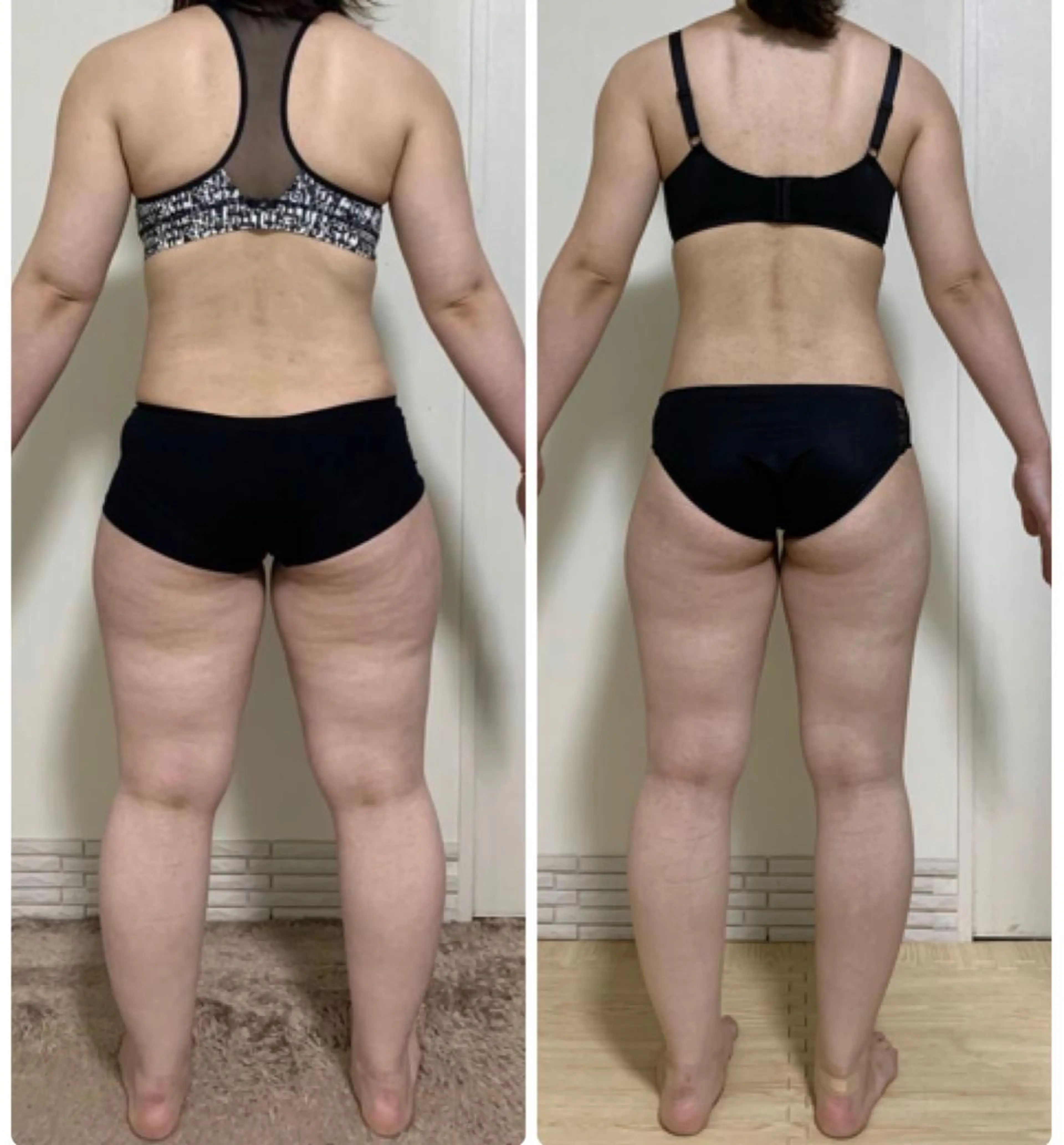 ニキビ・ 肌荒れ専門店のエステ・リラクイメージ