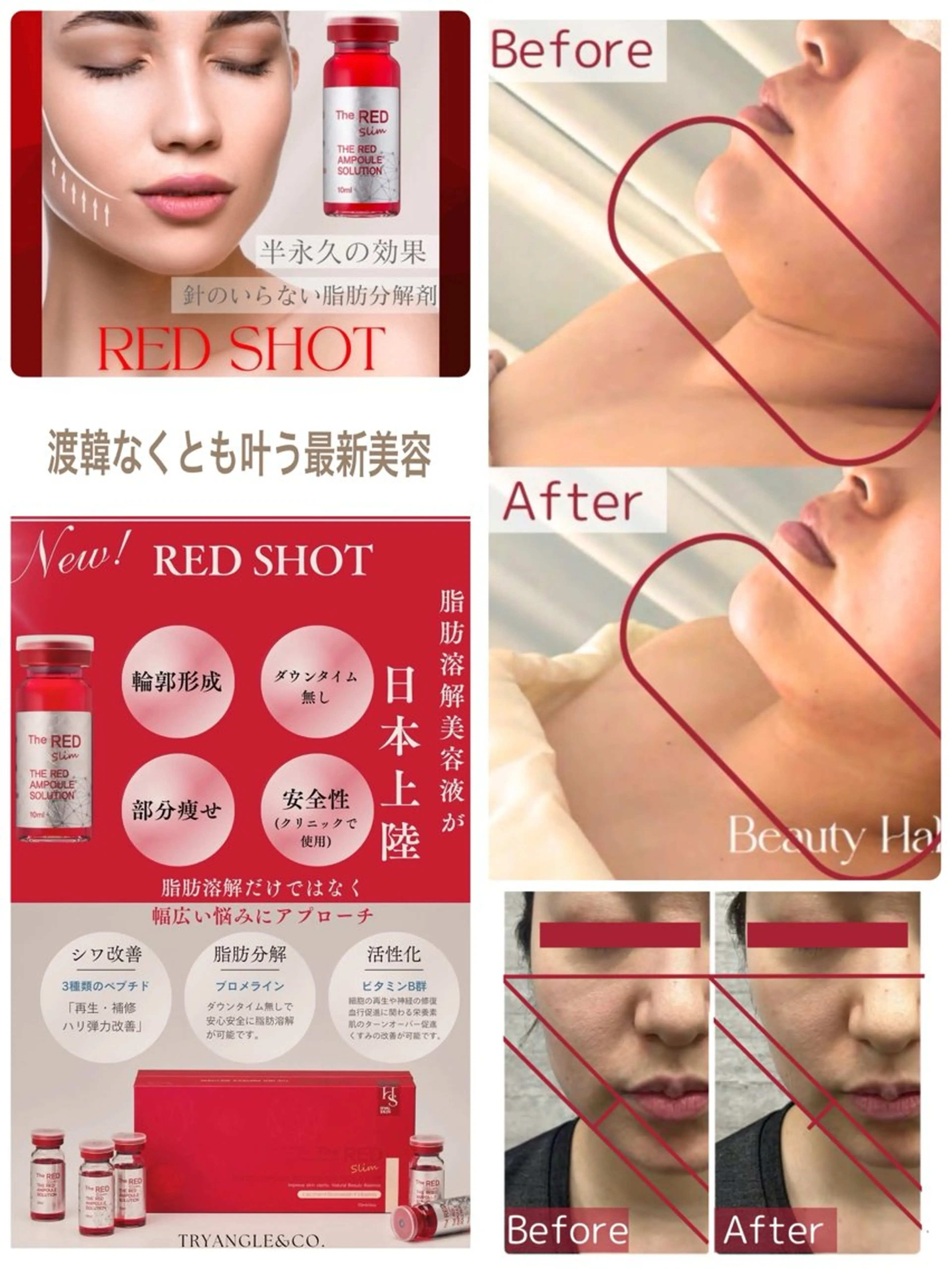 【渡韓知らずRED（気になる脂肪にアプローチ）】✖️プラズマシャワーの写真