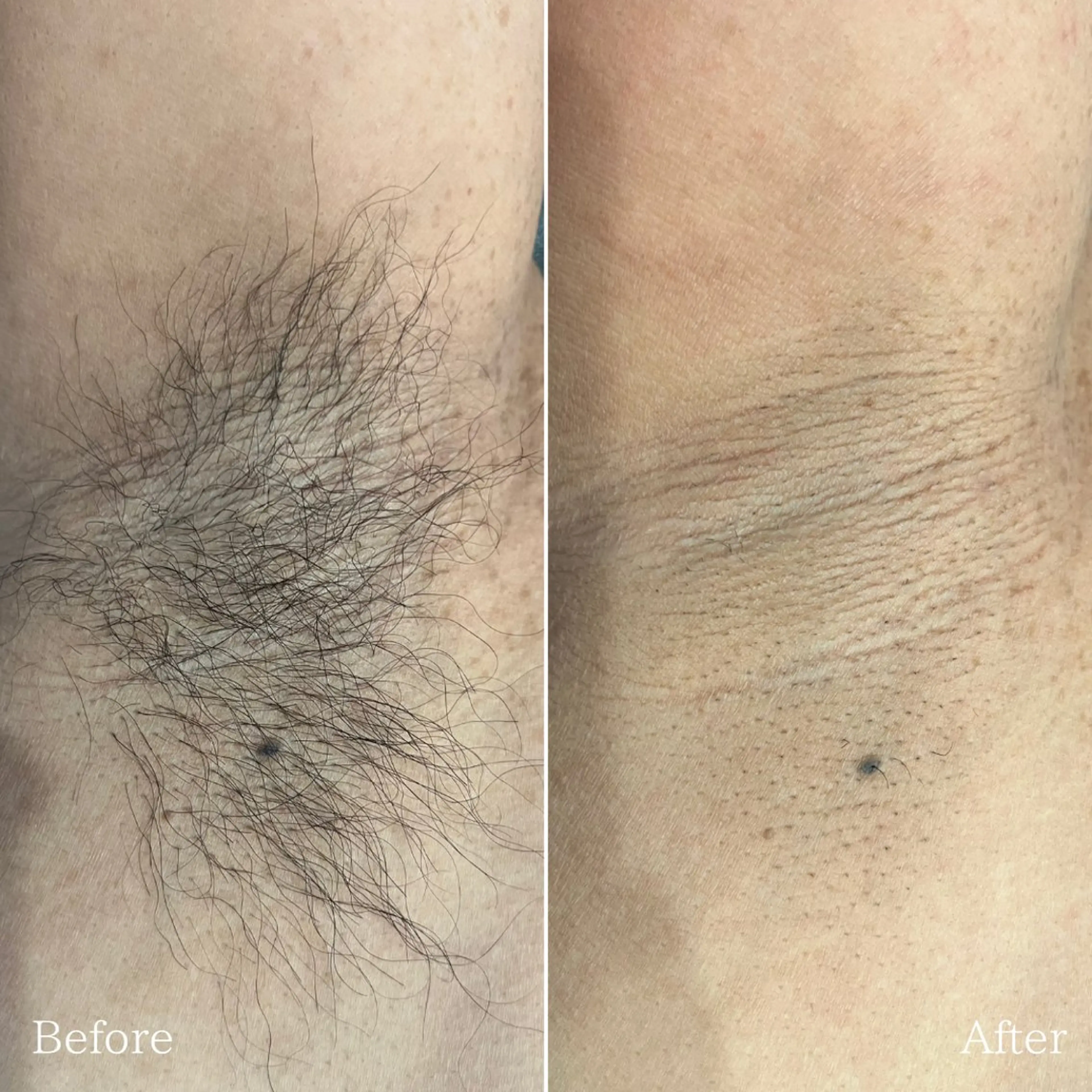 Cre A.所属・プライベートサロン Cre A.のエステ・リラクイメージ