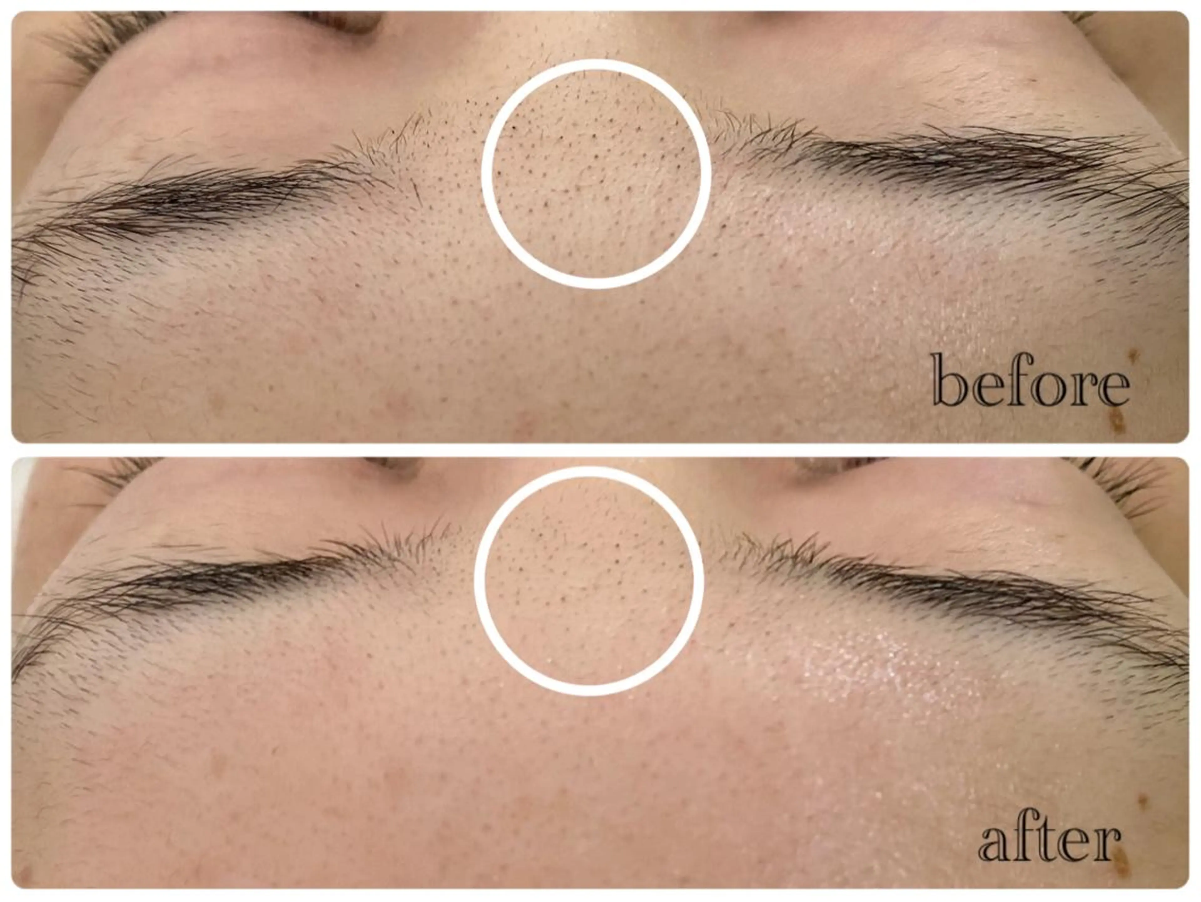 デ・アイム新潟北所属・サイトウ .のエステ・リラクイメージ