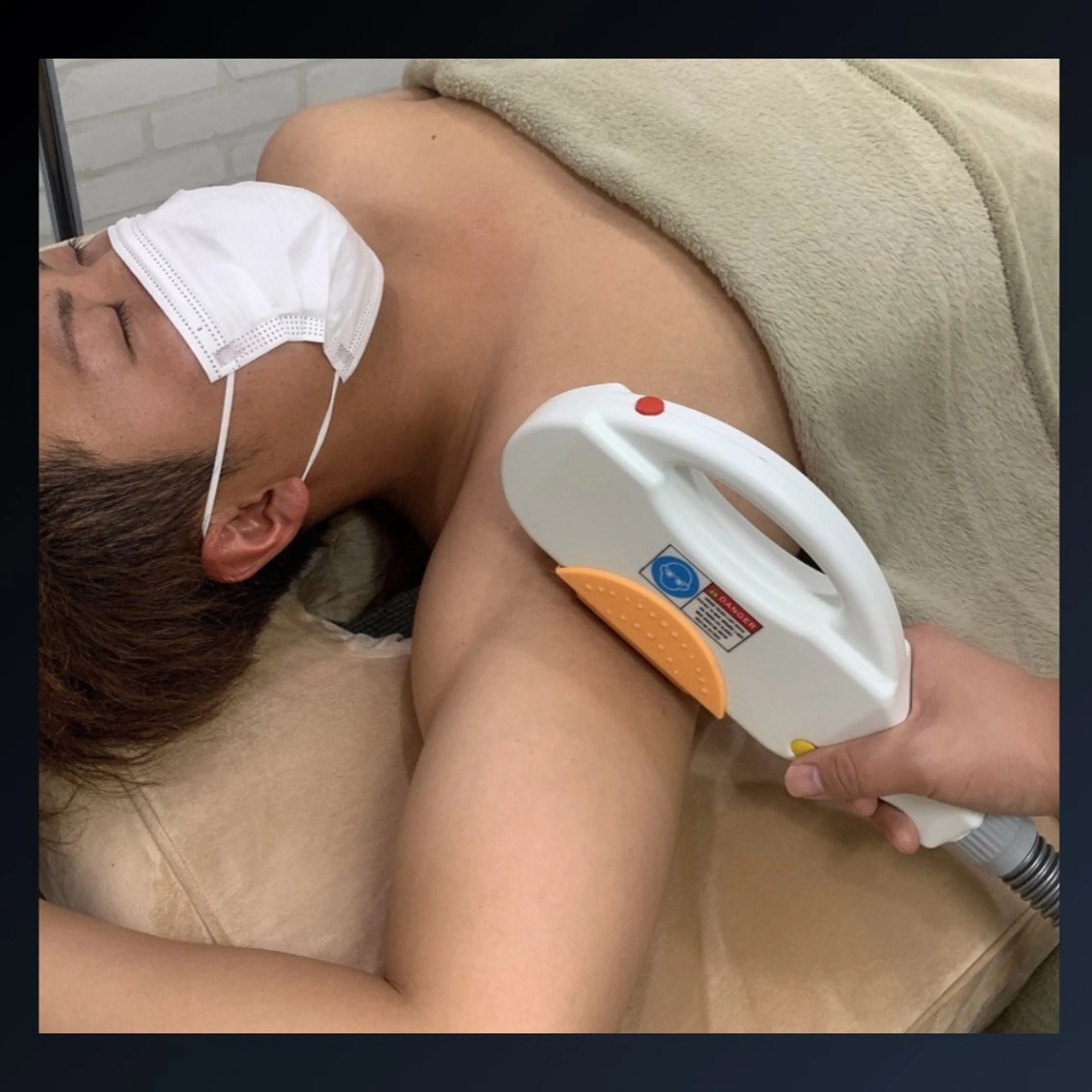 【残り2名様】  お好きな部位5箇所選んで集中脱毛!!の写真